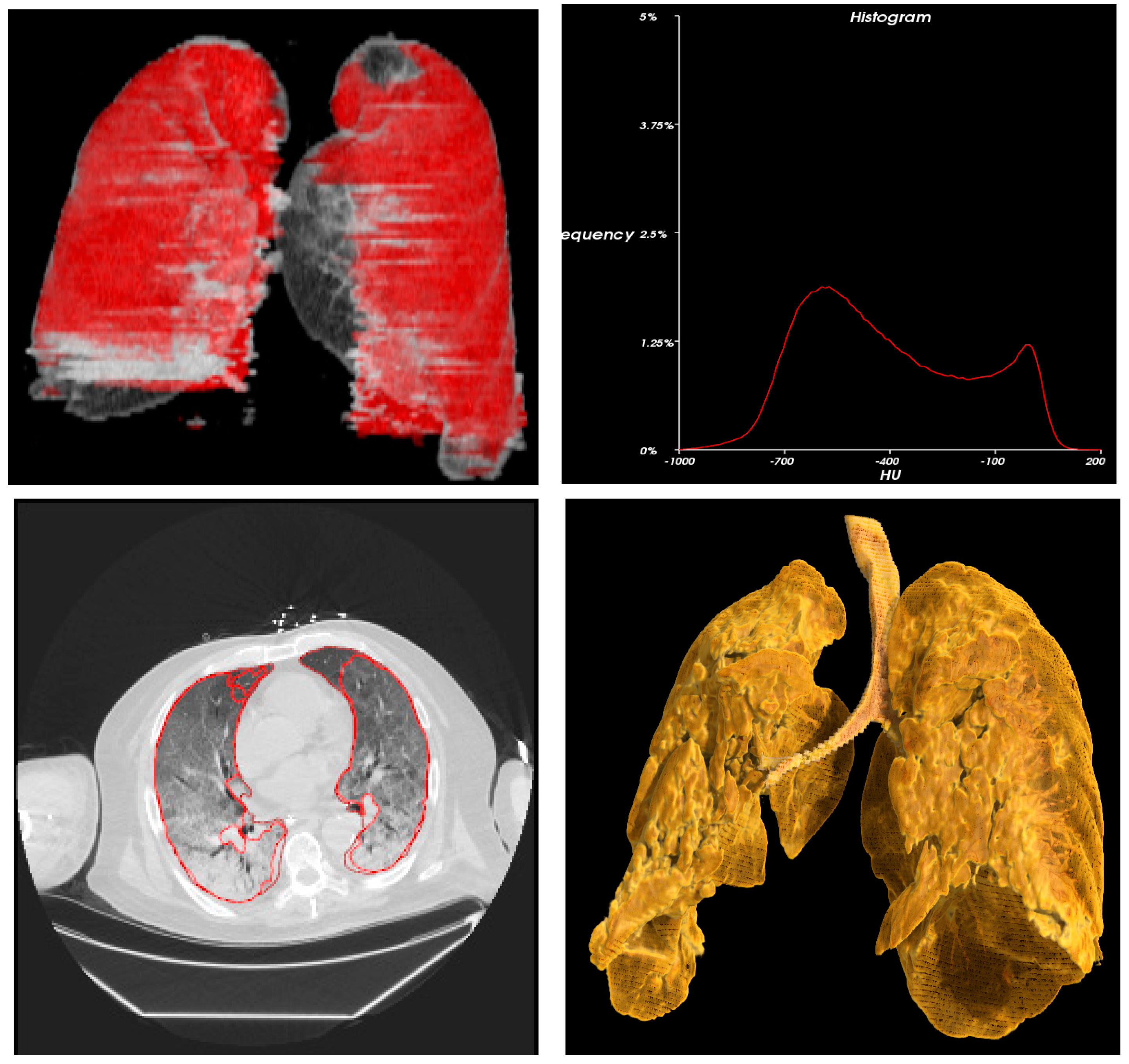 Cancers 15 00651 g004 Cancers 15 00651 g004