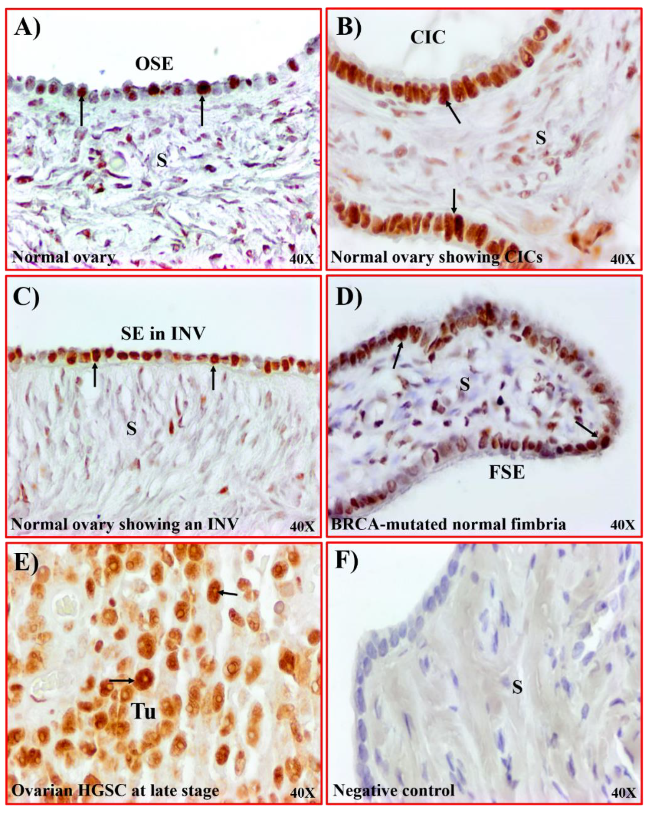 Cancers 15 00661 g004 Cancers 15 00661 g004
