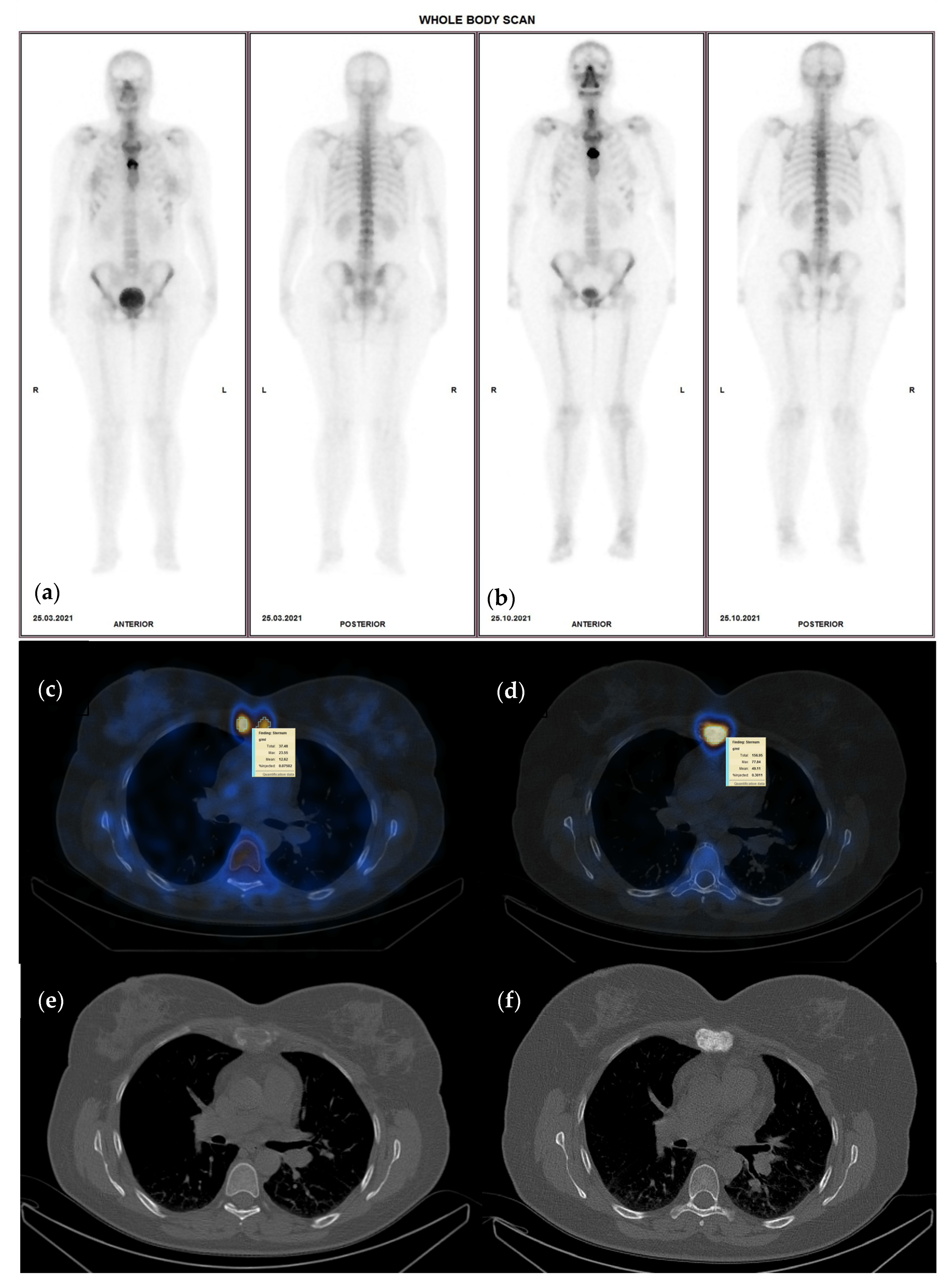 Cancers 15 00696 g001