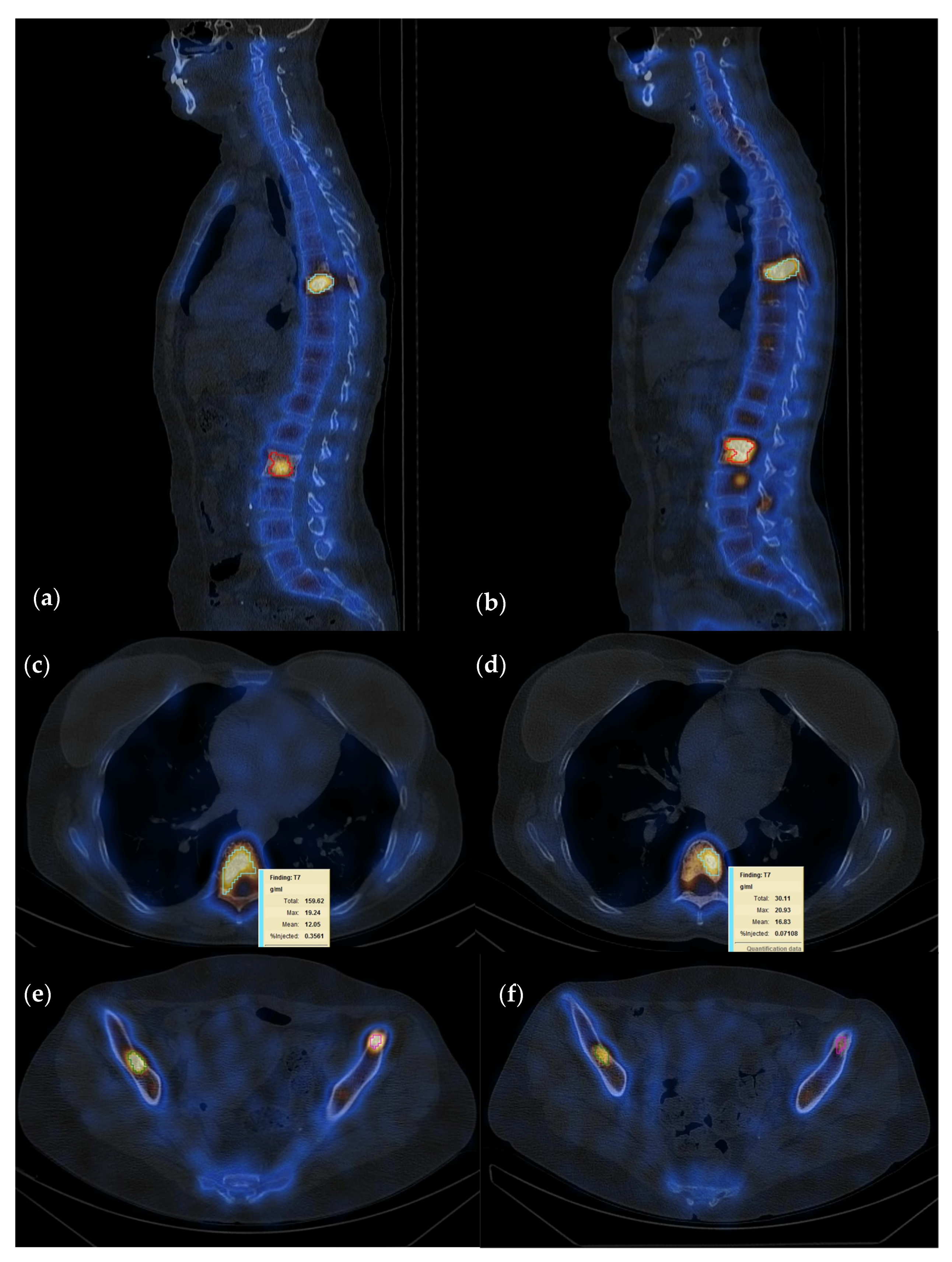 Cancers 15 00696 g002