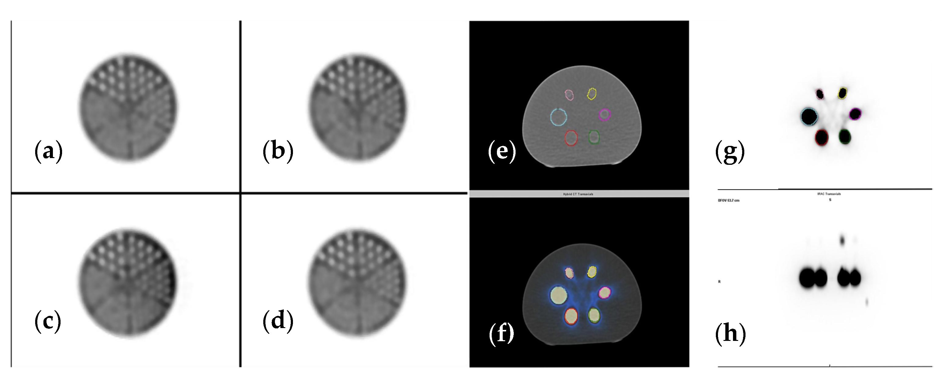 Cancers 15 00696 g004