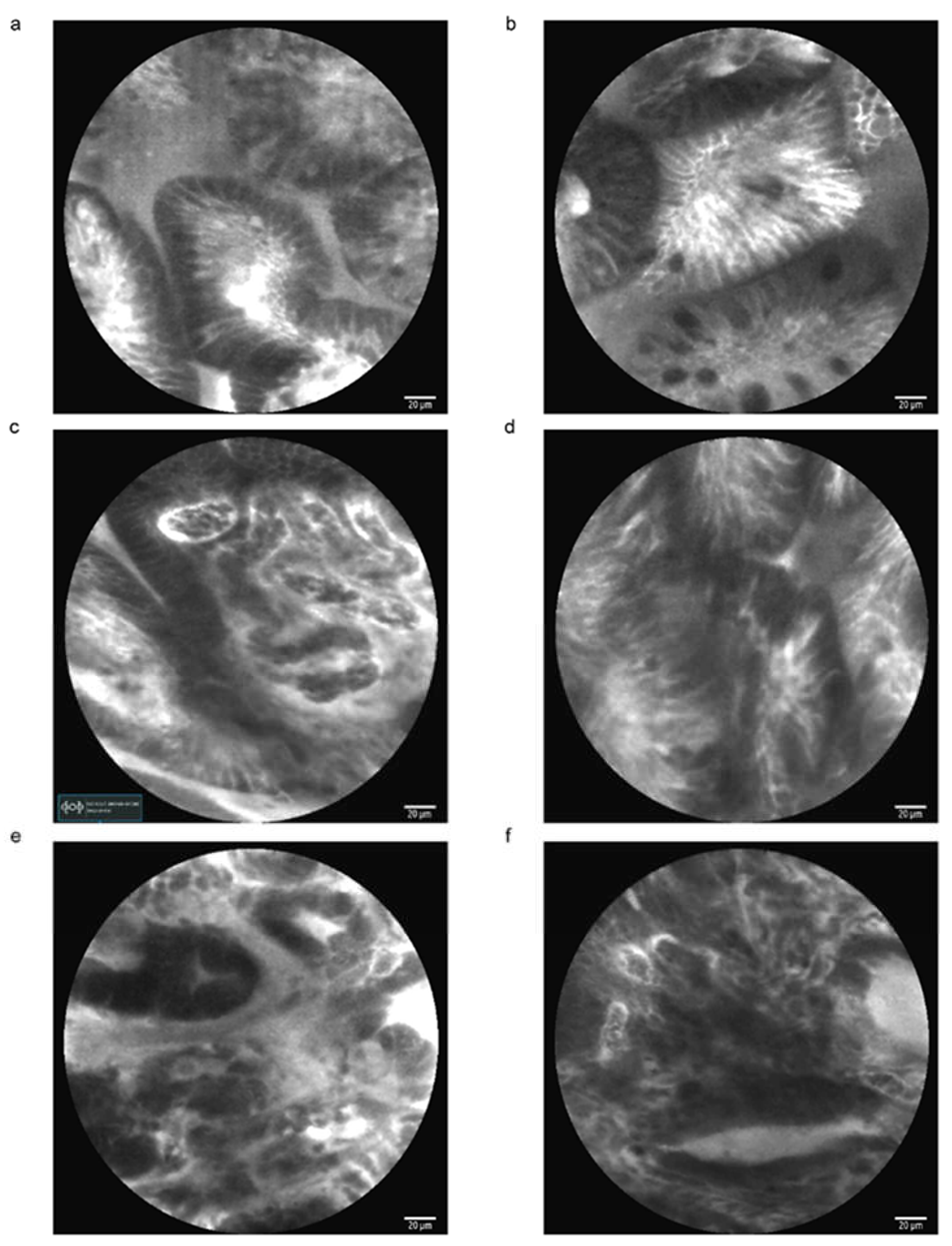 Cancers 15 00776 g002