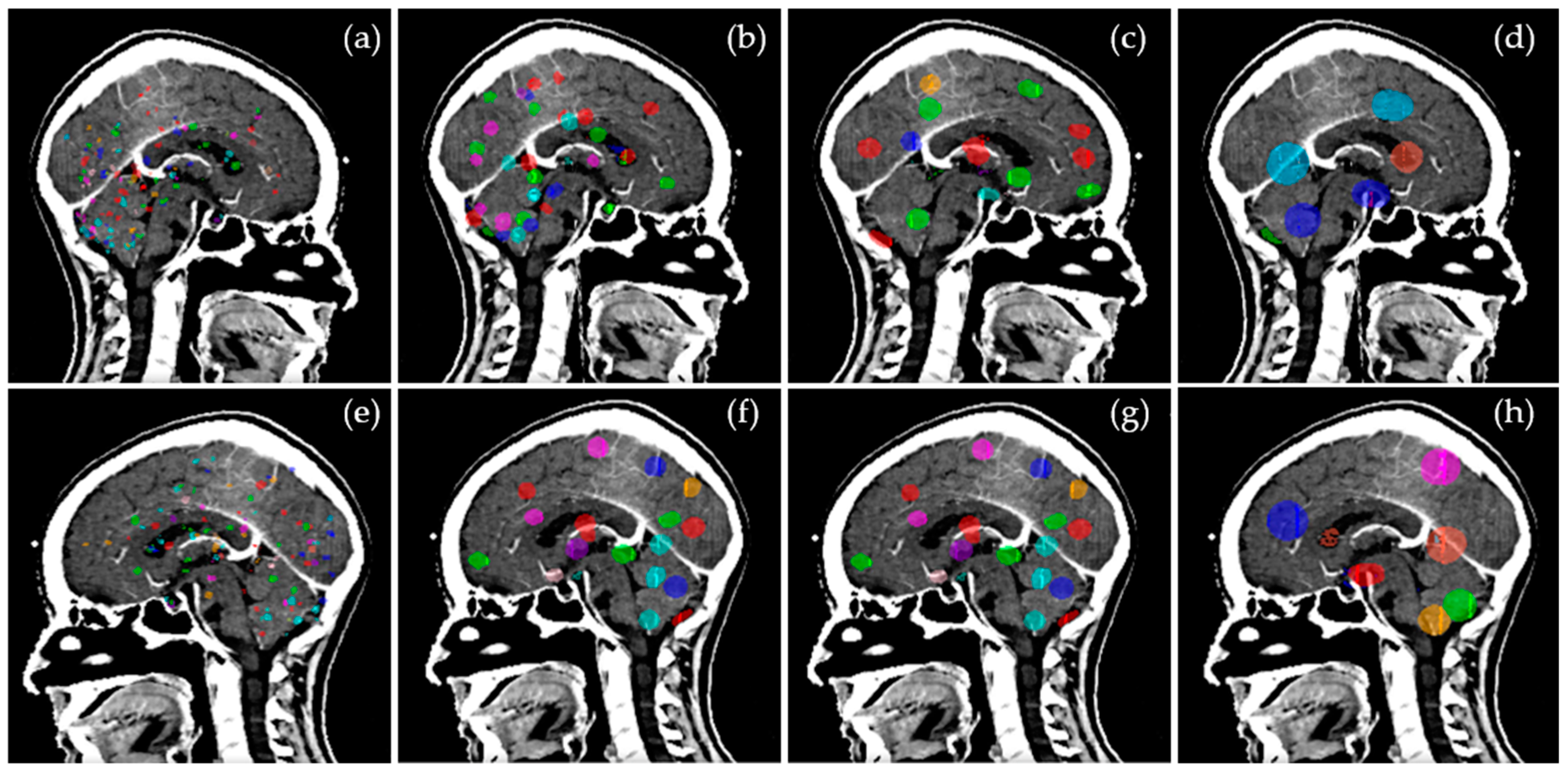 Cancers 15 00780 g002 Cancers 15 00780 g002