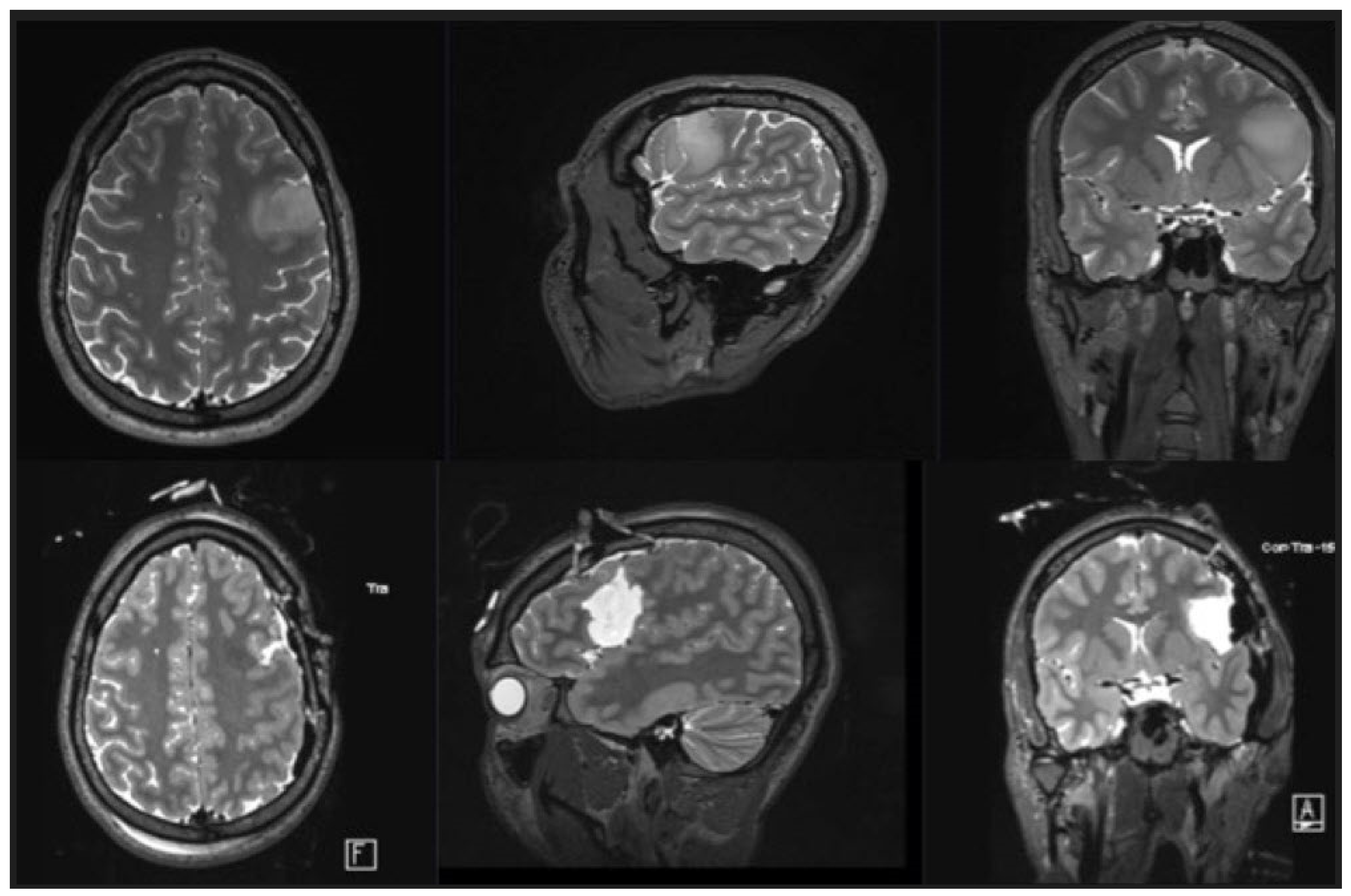 Cancers 15 00781 g003 Cancers 15 00781 g003