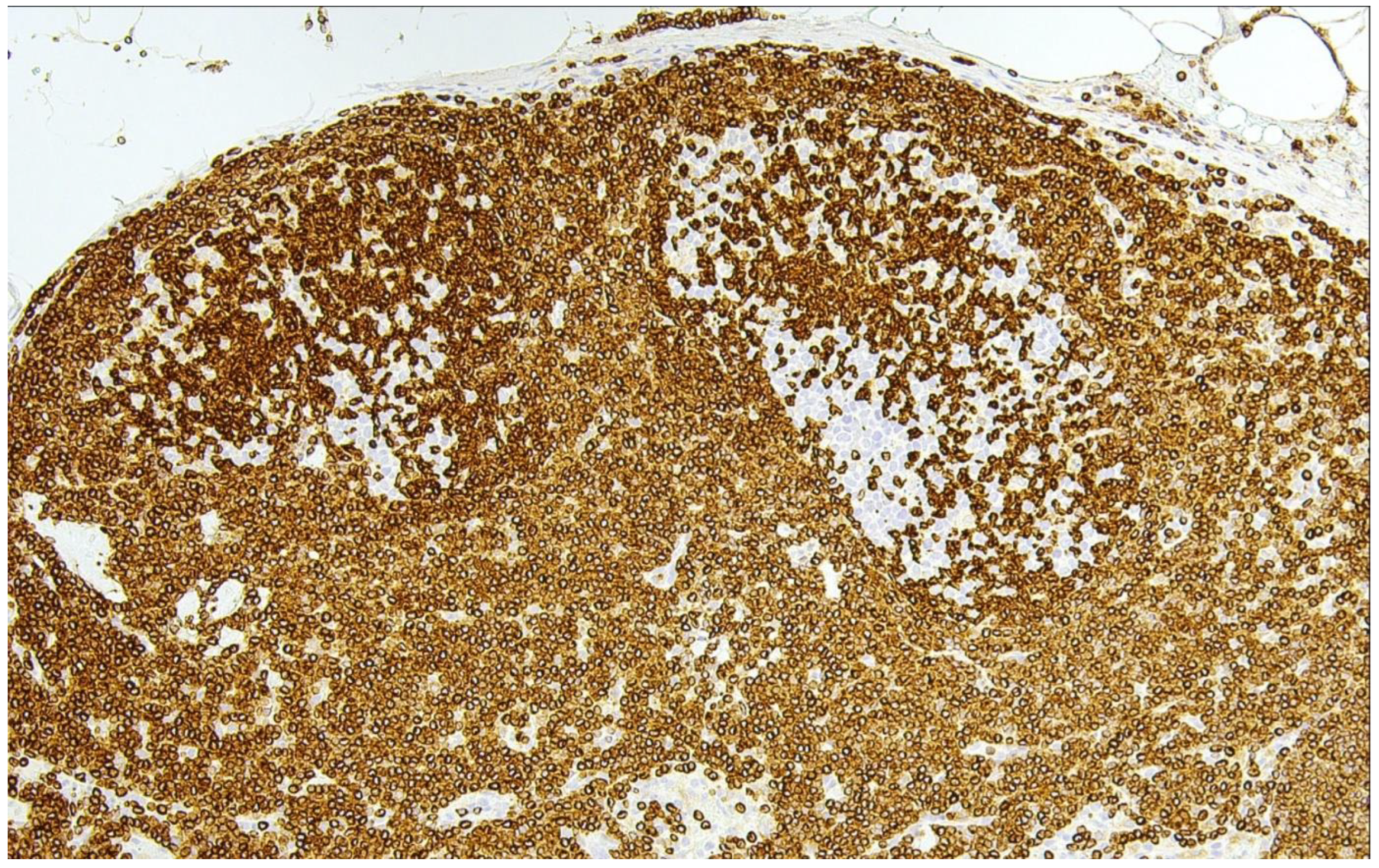 Cancers 15 00785 g001