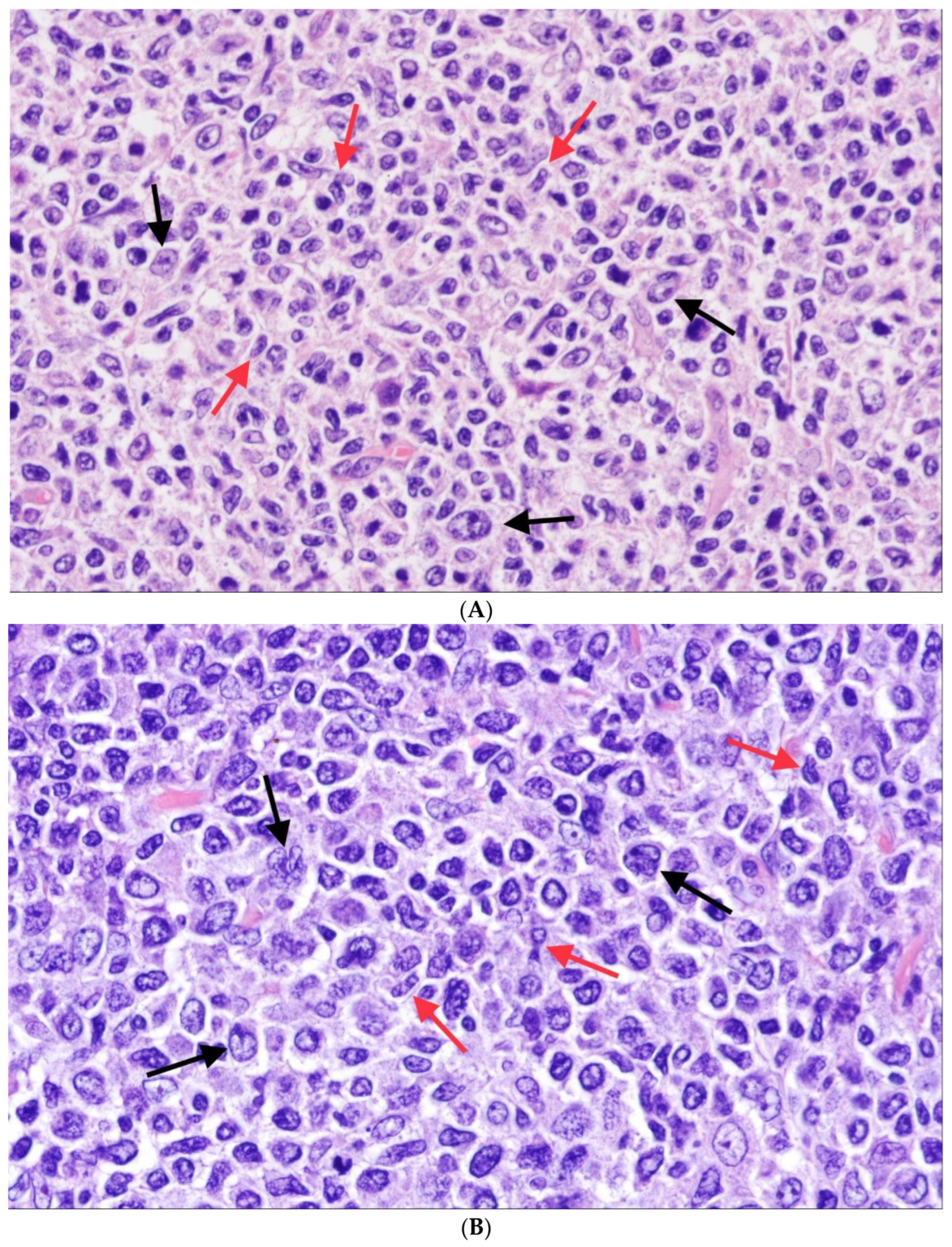 Cancers 15 00785 g002