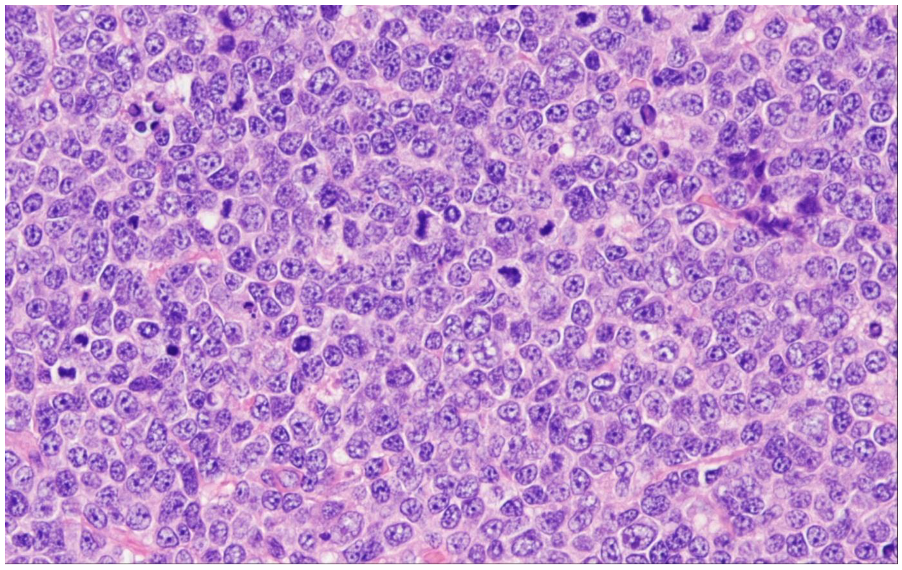 Cancers 15 00785 g004