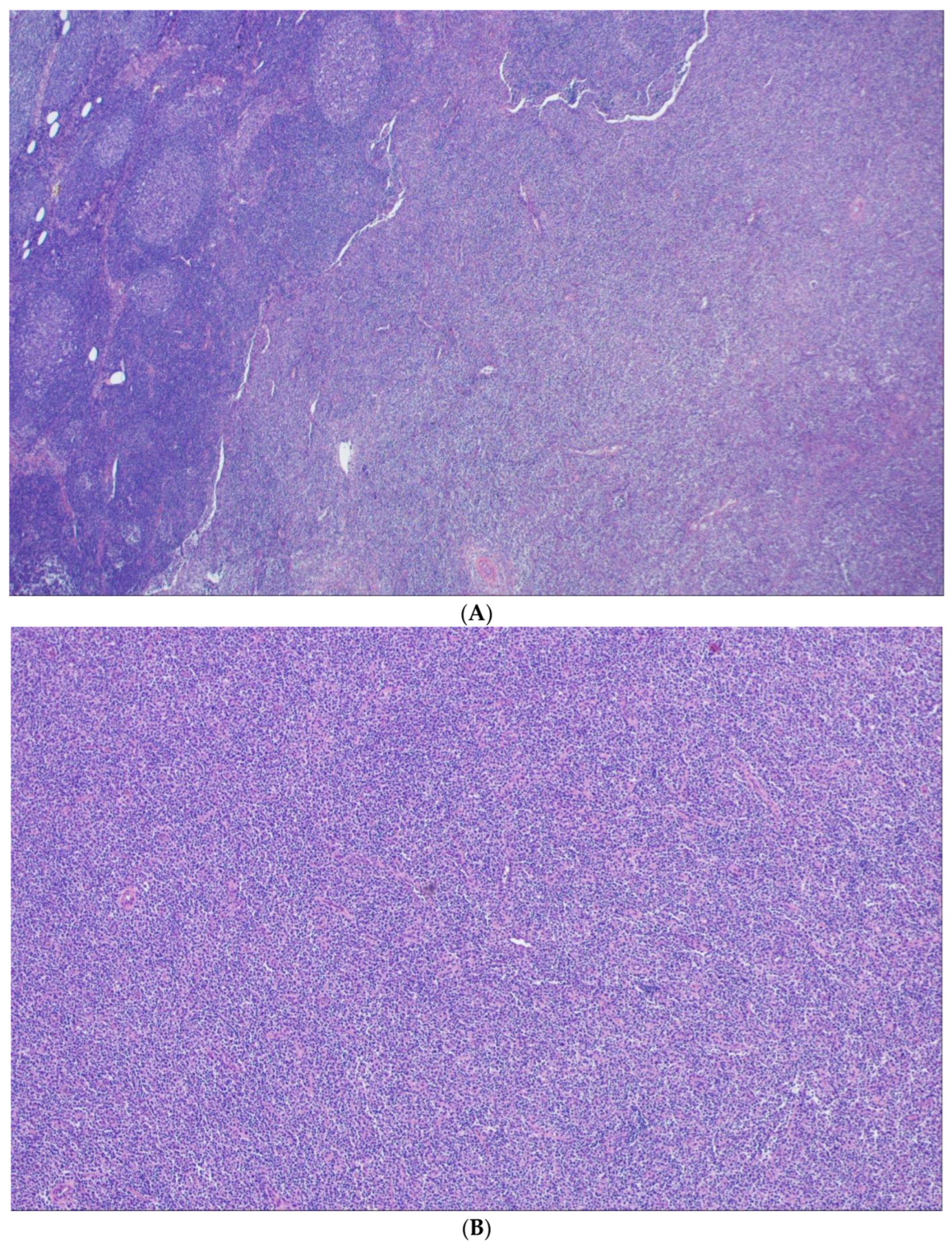 Cancers 15 00785 g005