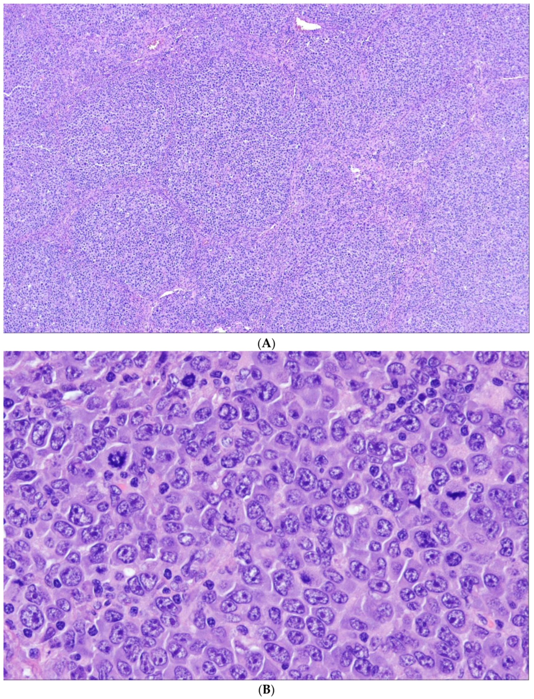 Cancers 15 00785 g006