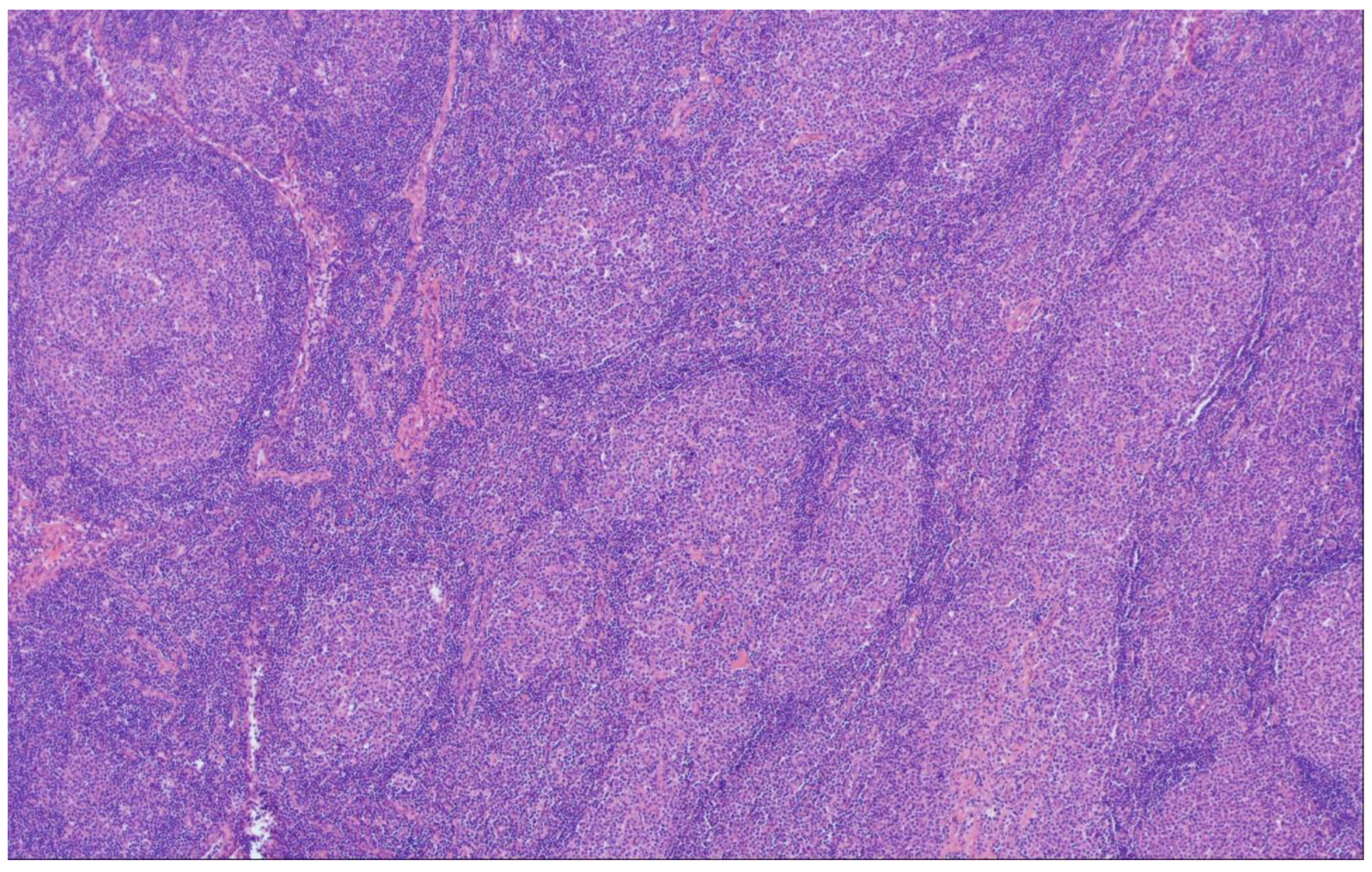 Cancers 15 00785 g007