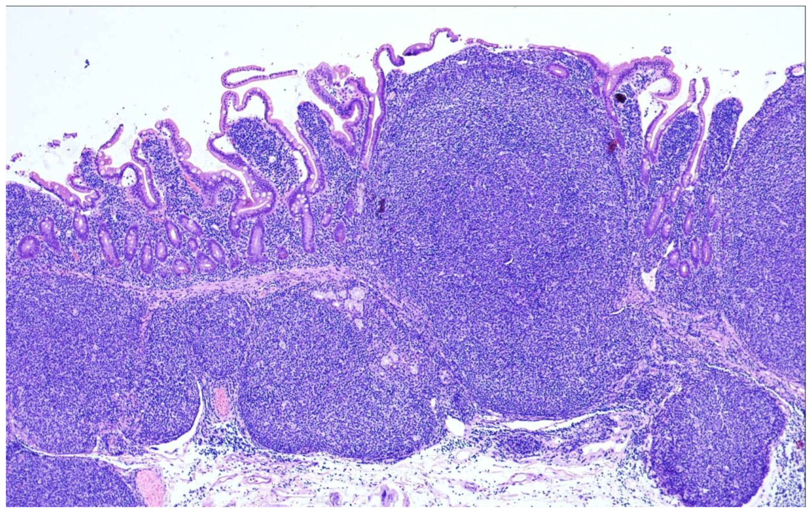 Cancers 15 00785 g008