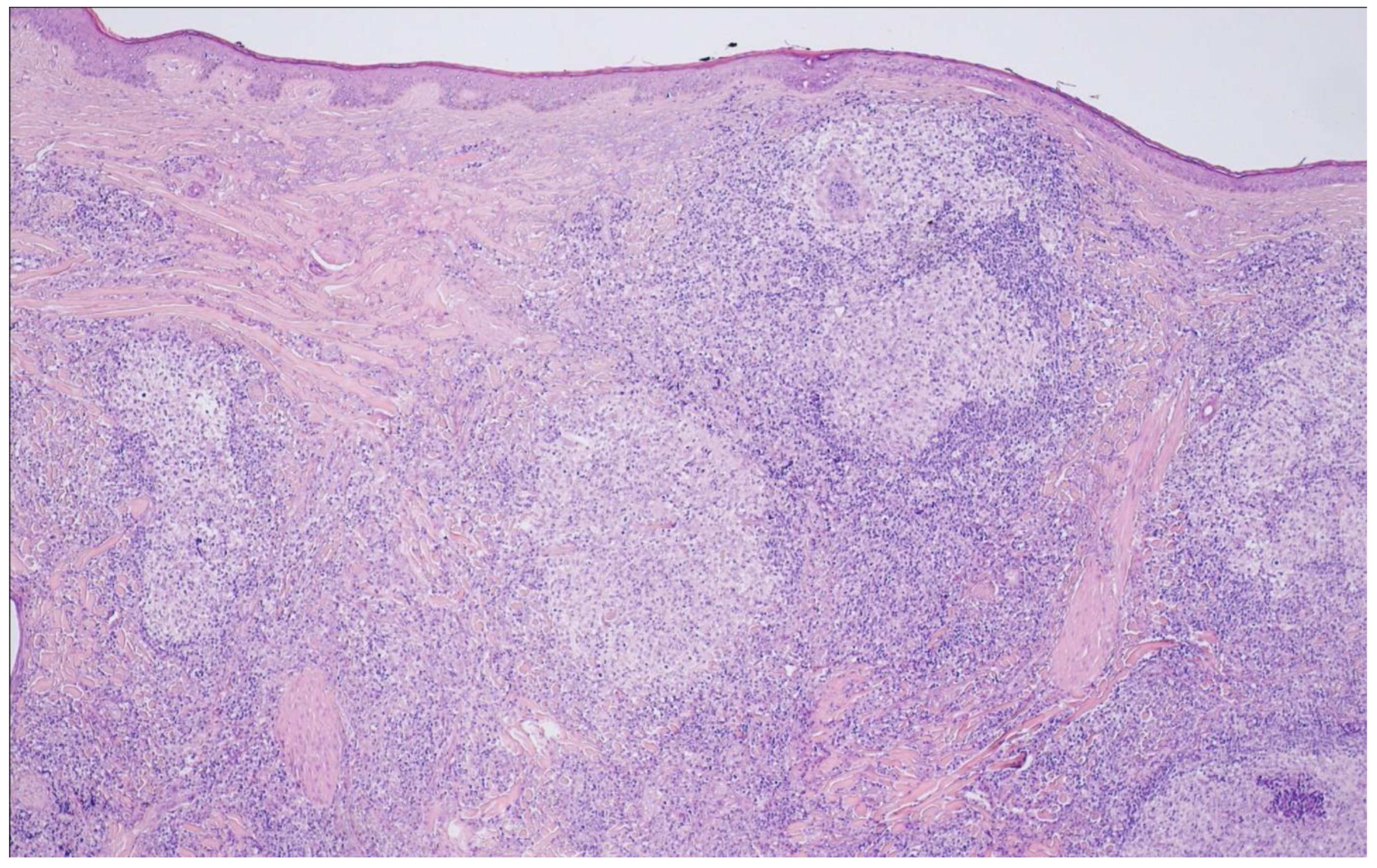 Cancers 15 00785 g009