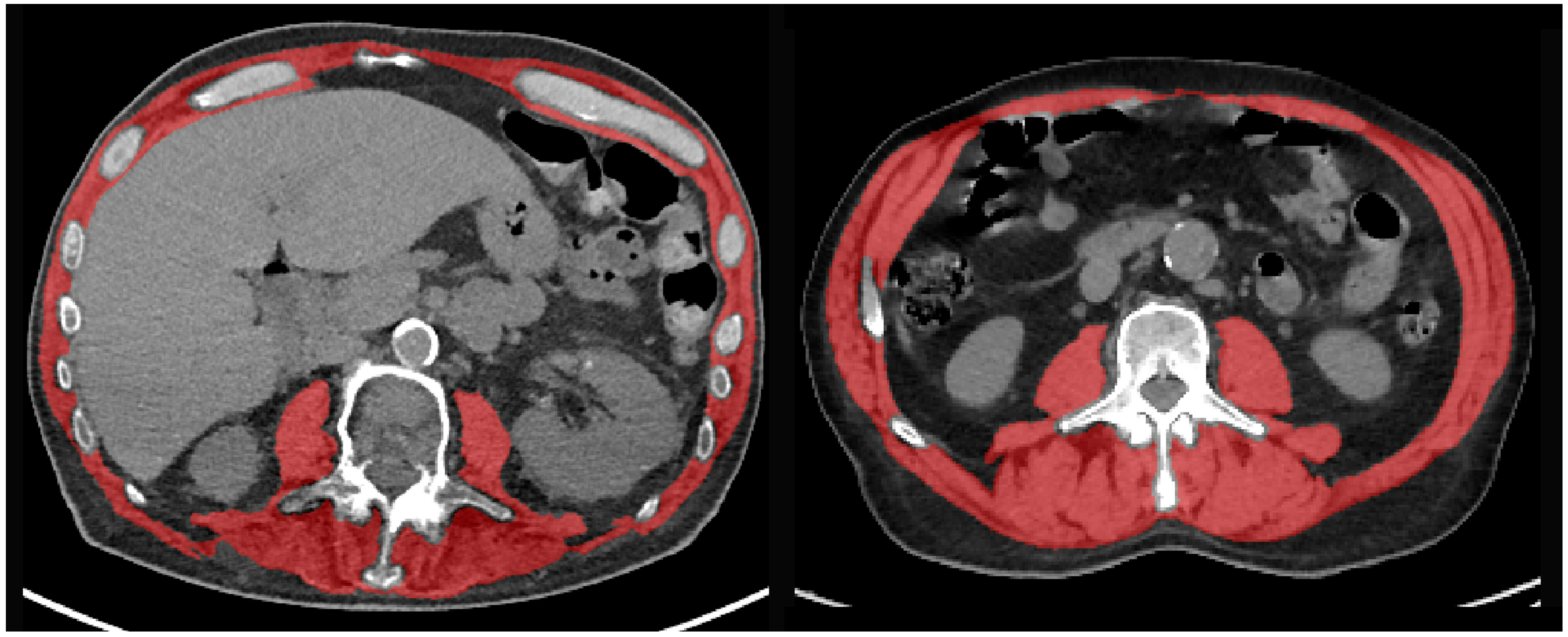 Cancers 15 00790 g002