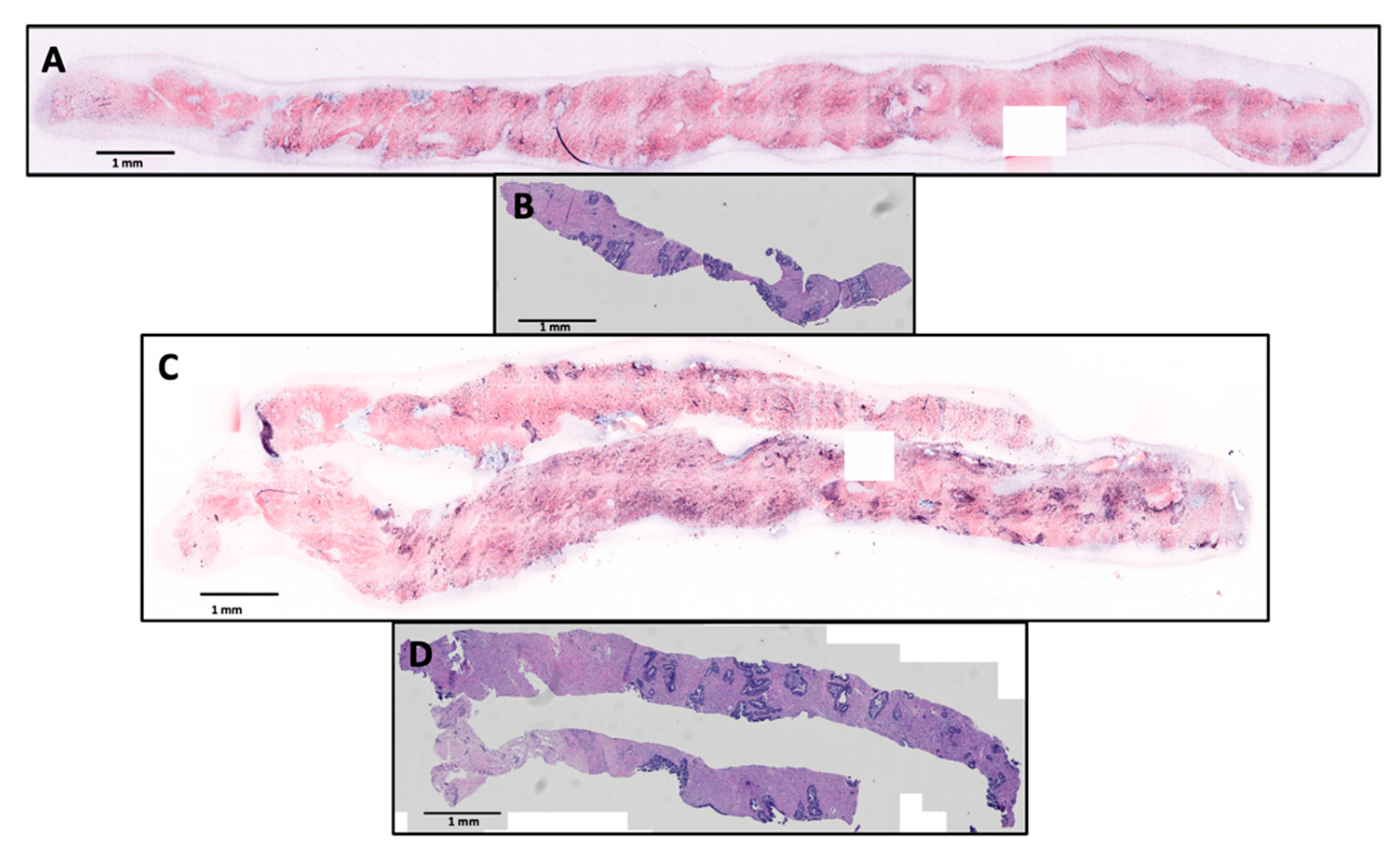 Cancers 15 00792 g002