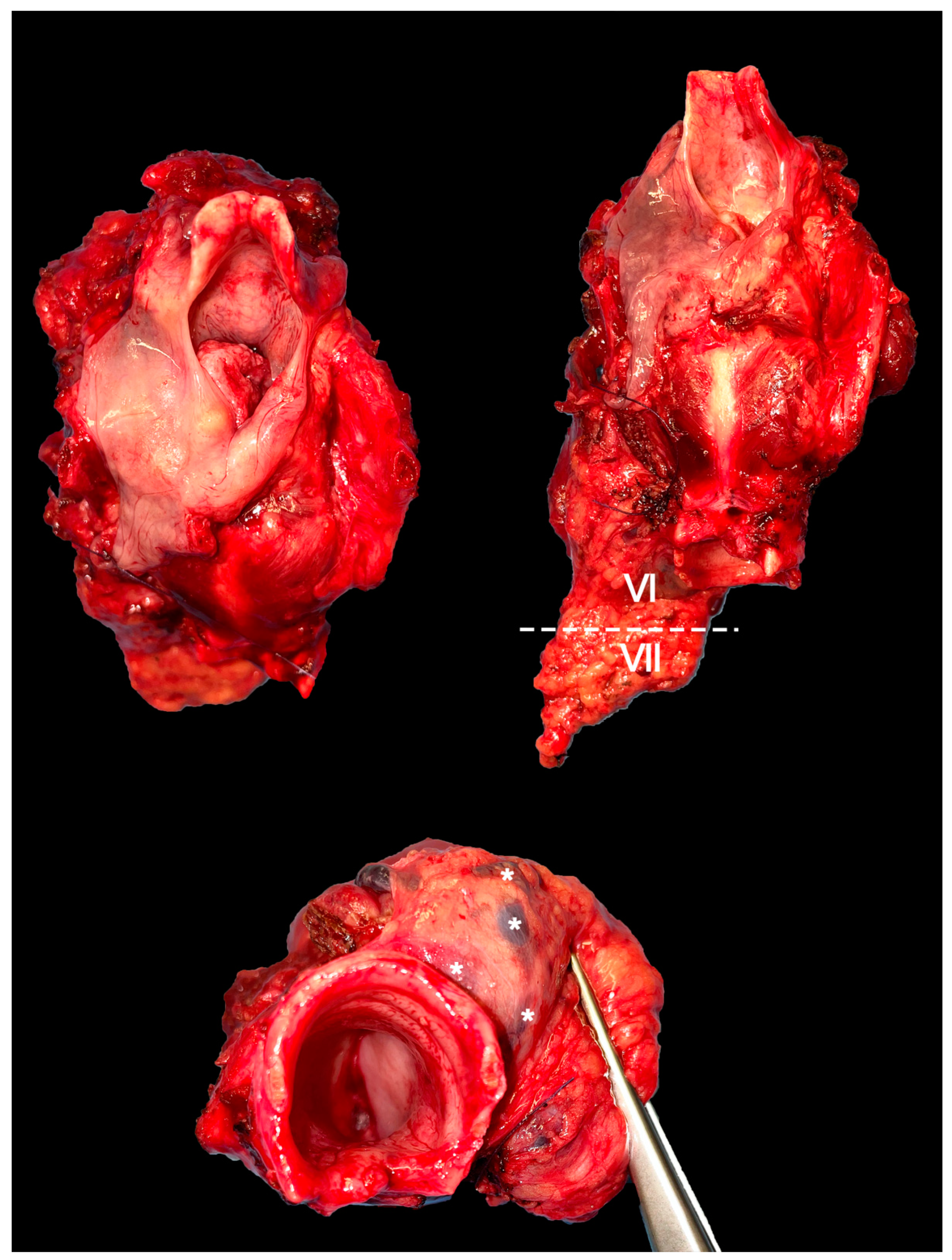 Cancers 15 00804 g002