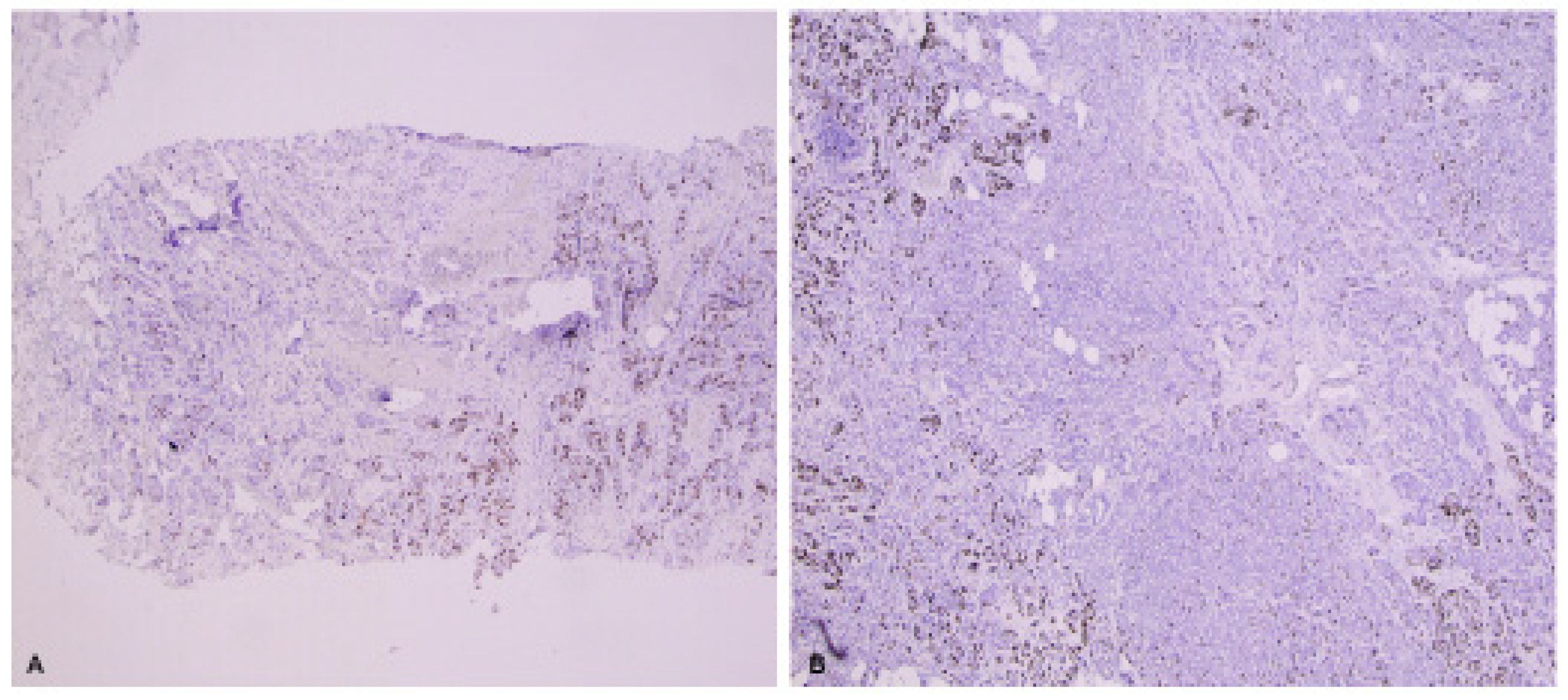 Cancers 15 00808 g003