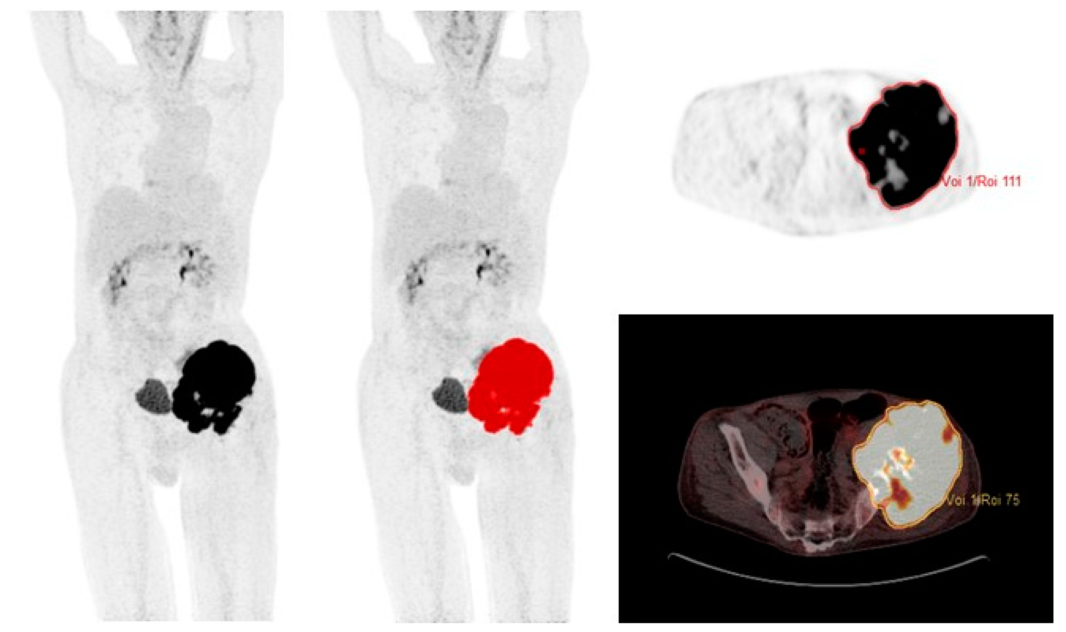 Cancers 15 00816 g001 Cancers 15 00816 g001