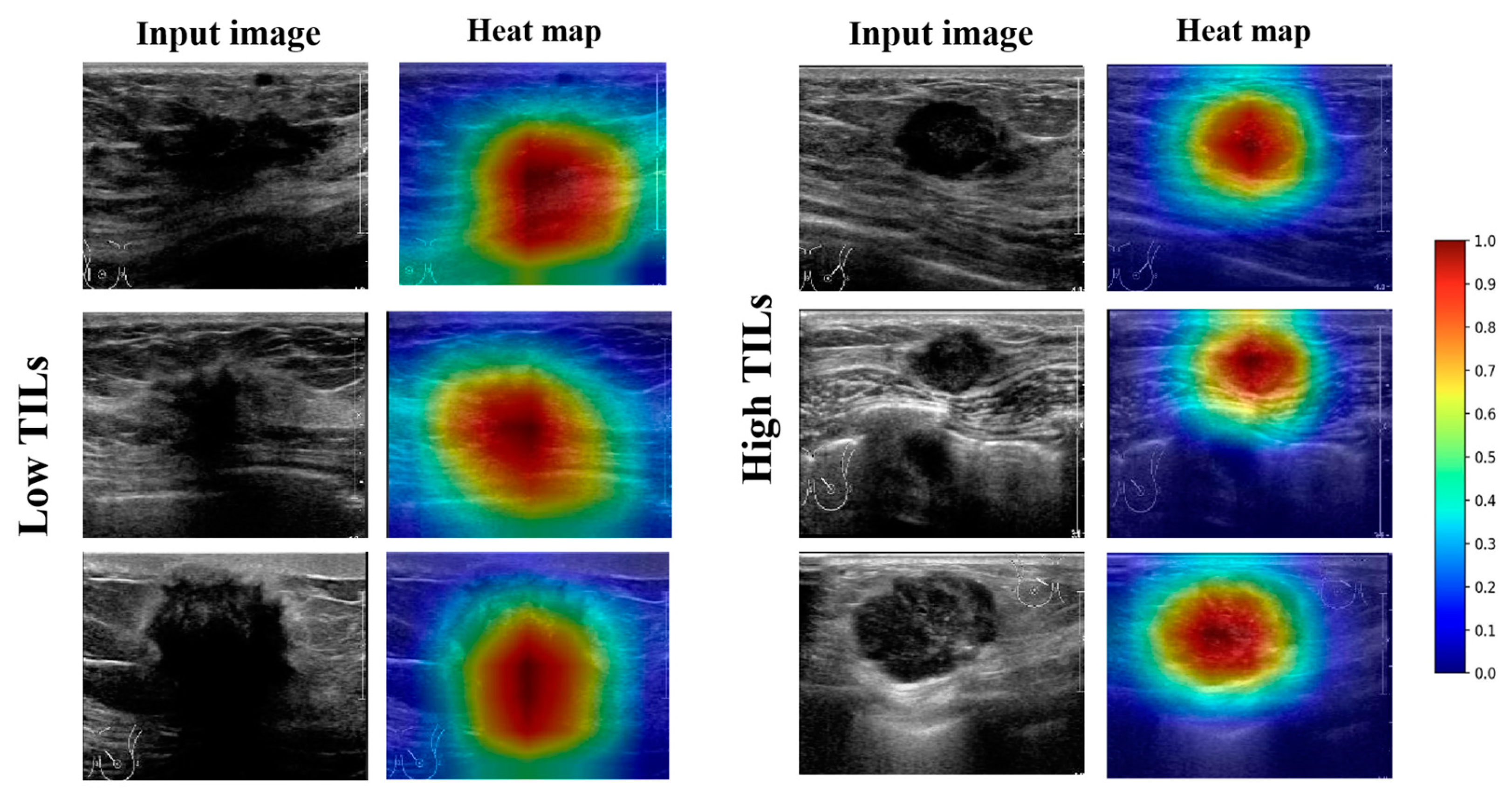 Cancers 15 00838 g006 Cancers 15 00838 g006