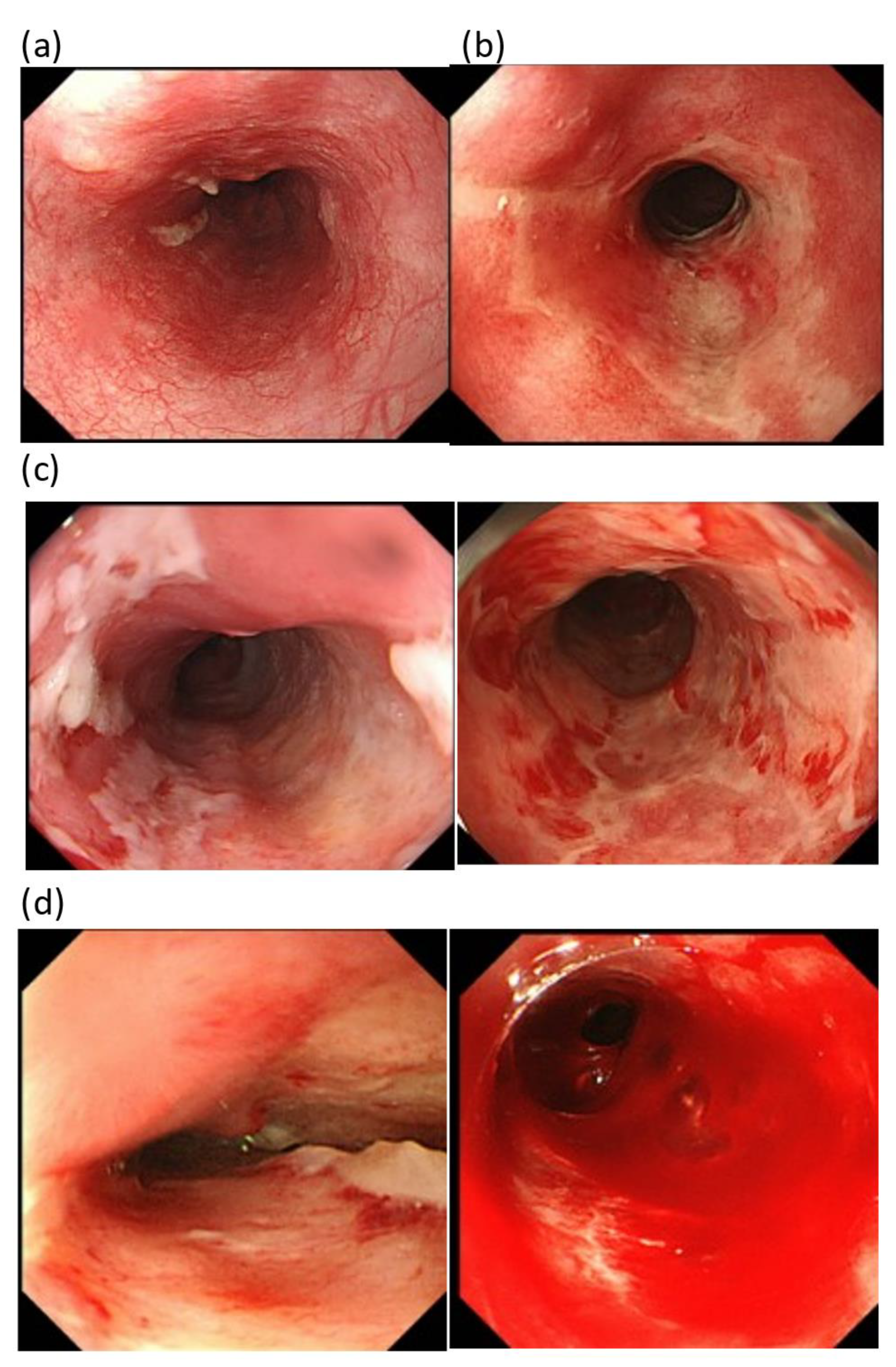 Cancers 15 00860 g001