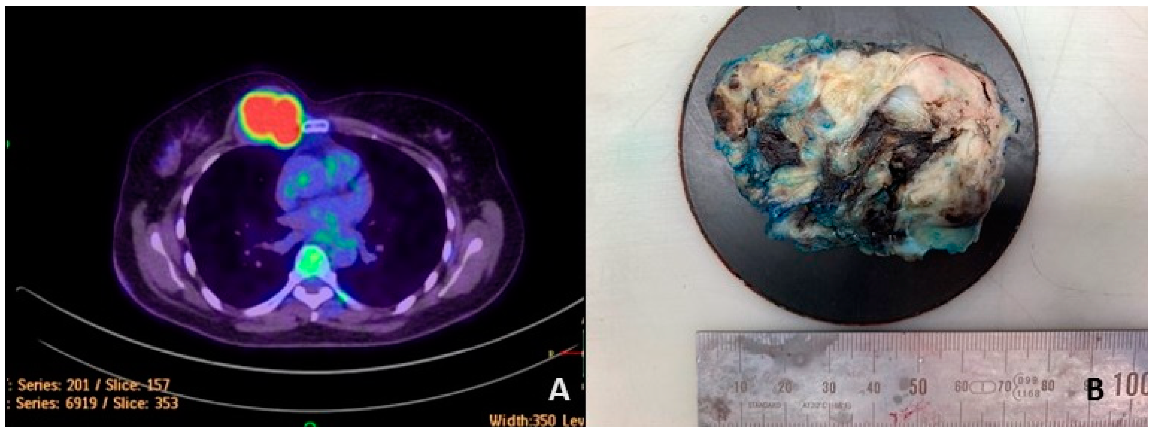 Cancers 15 00898 g001