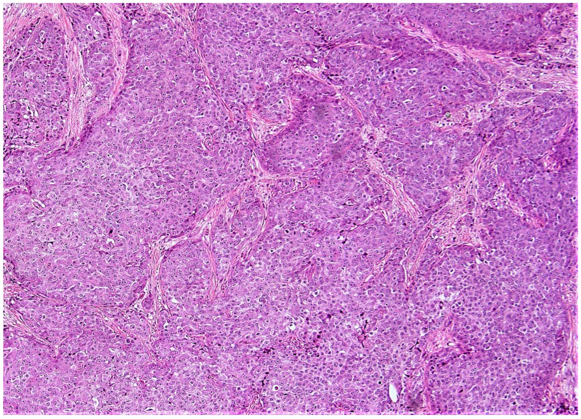 Cancers 15 00903 g006 Cancers 15 00903 g006