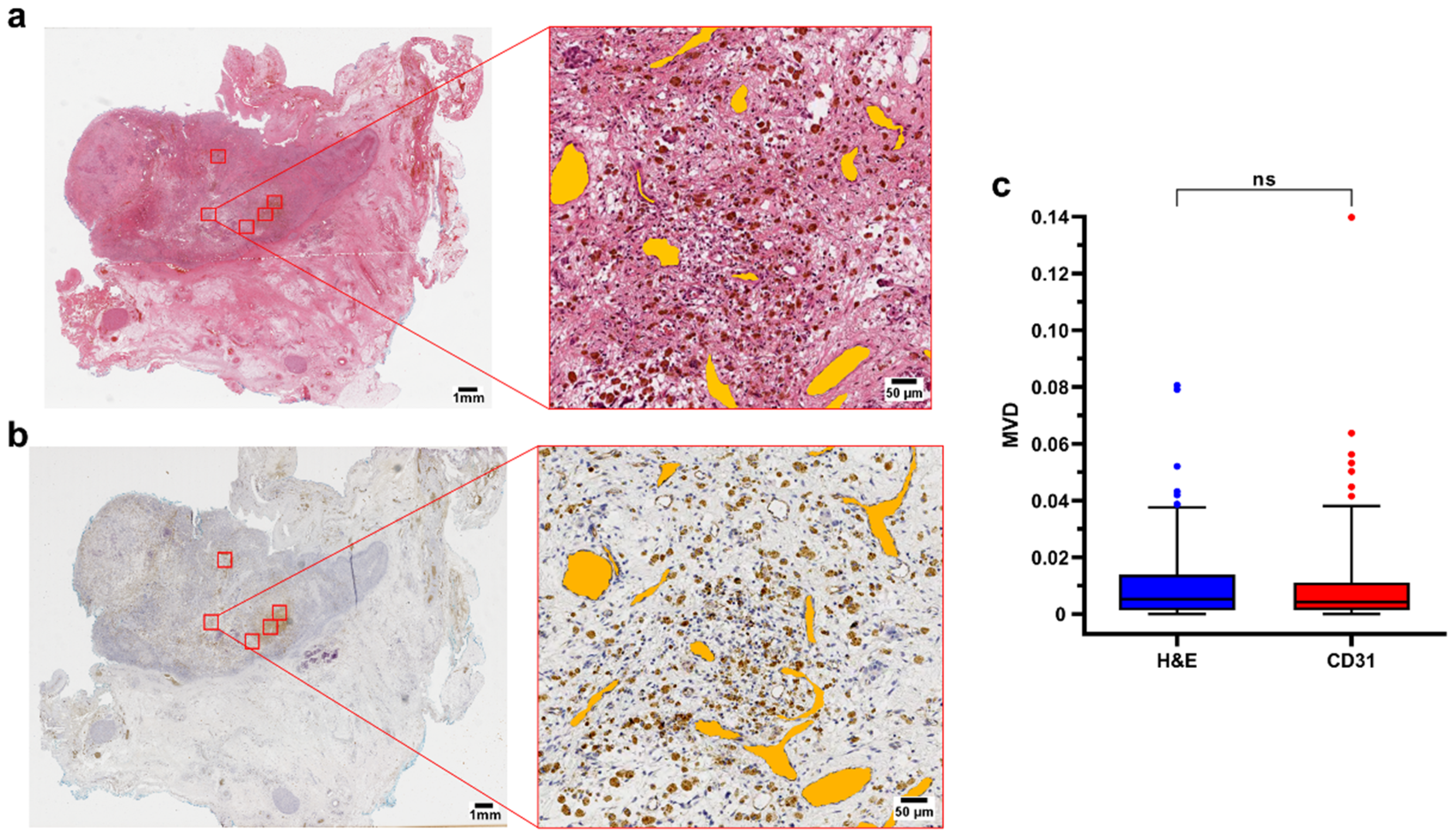 Cancers 15 00917 g001 Cancers 15 00917 g001