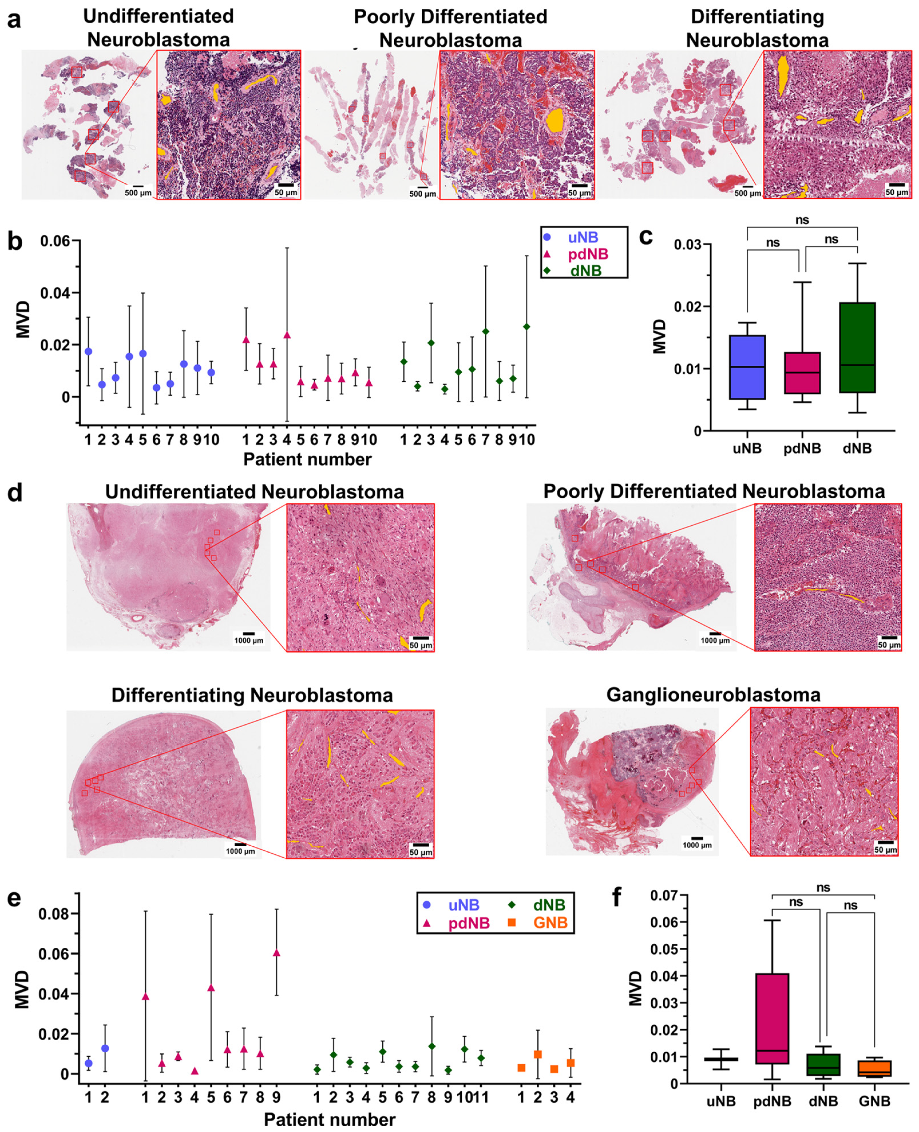 Cancers 15 00917 g002 Cancers 15 00917 g002