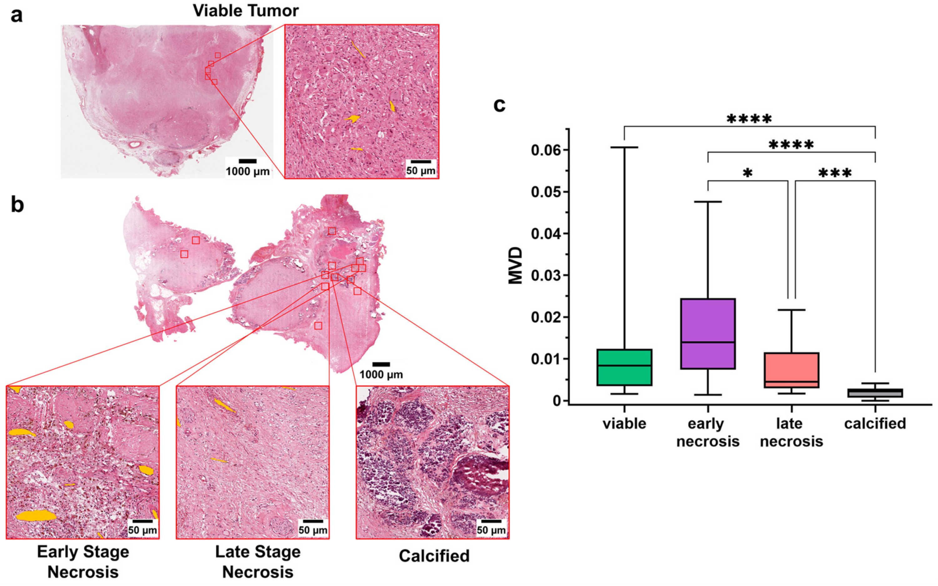 Cancers 15 00917 g003 Cancers 15 00917 g003