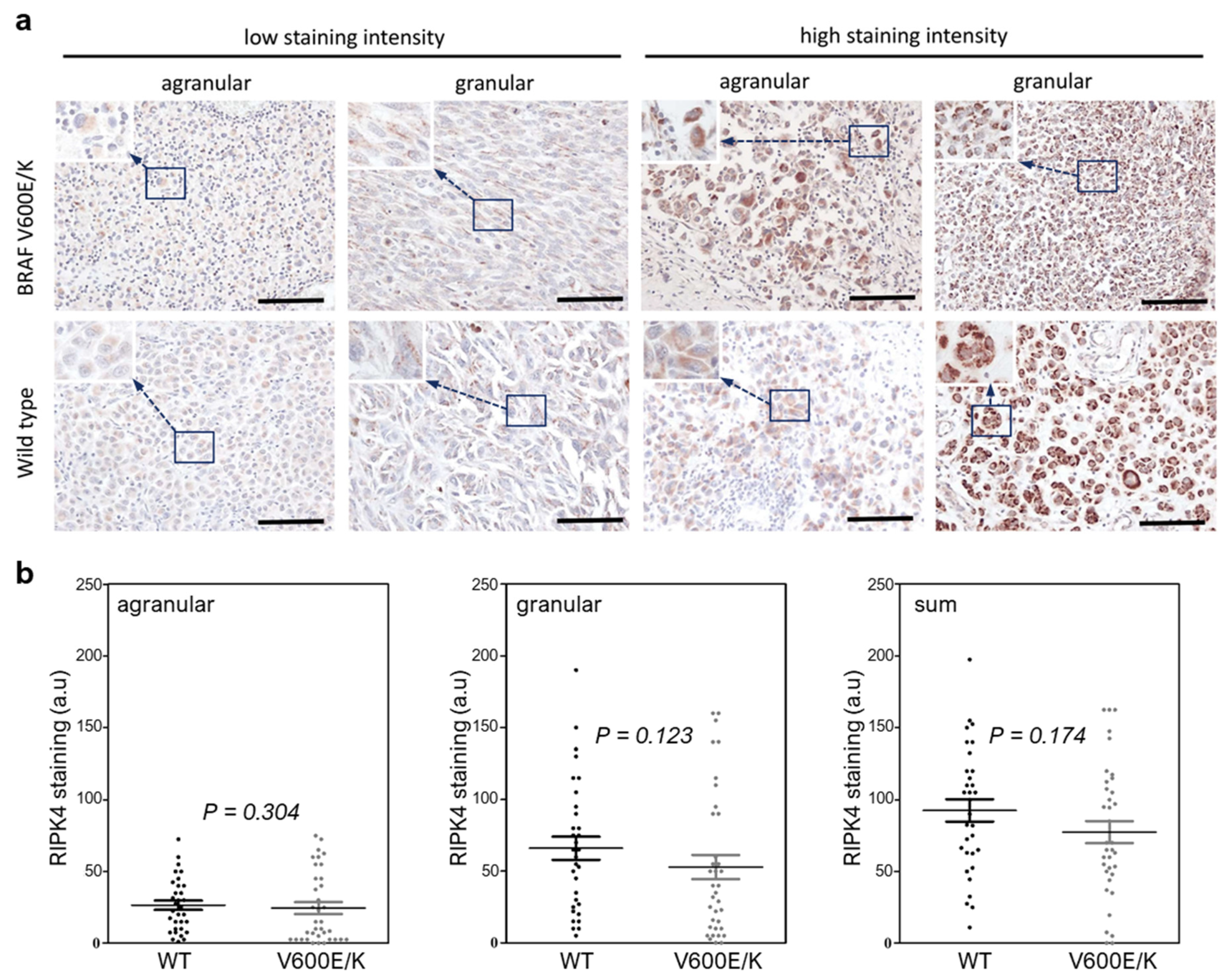Cancers 15 00918 g002 Cancers 15 00918 g002