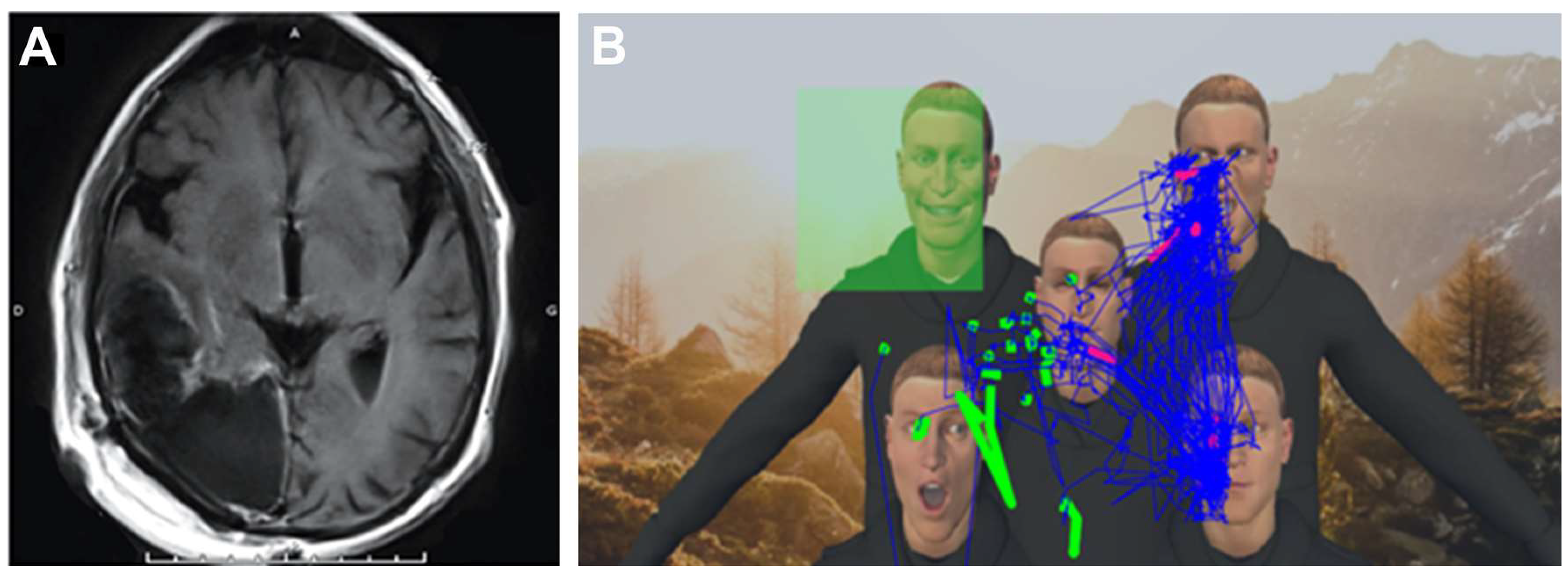 Cancers 15 00949 g003 550