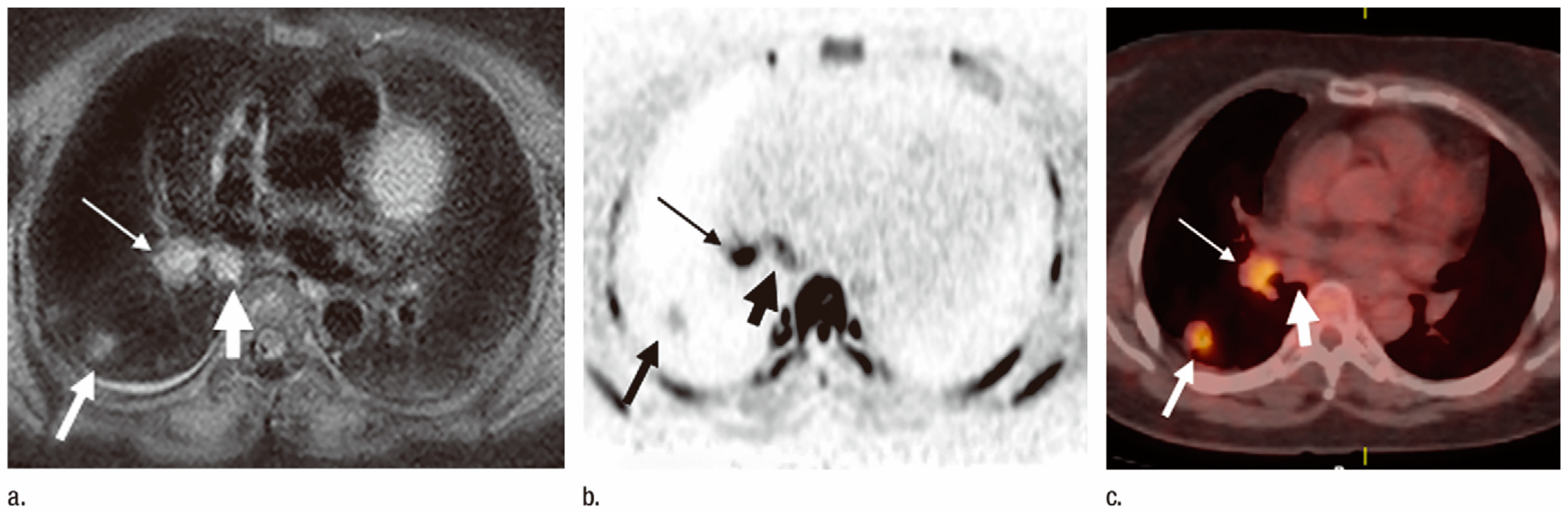 Cancers 15 00950 g002