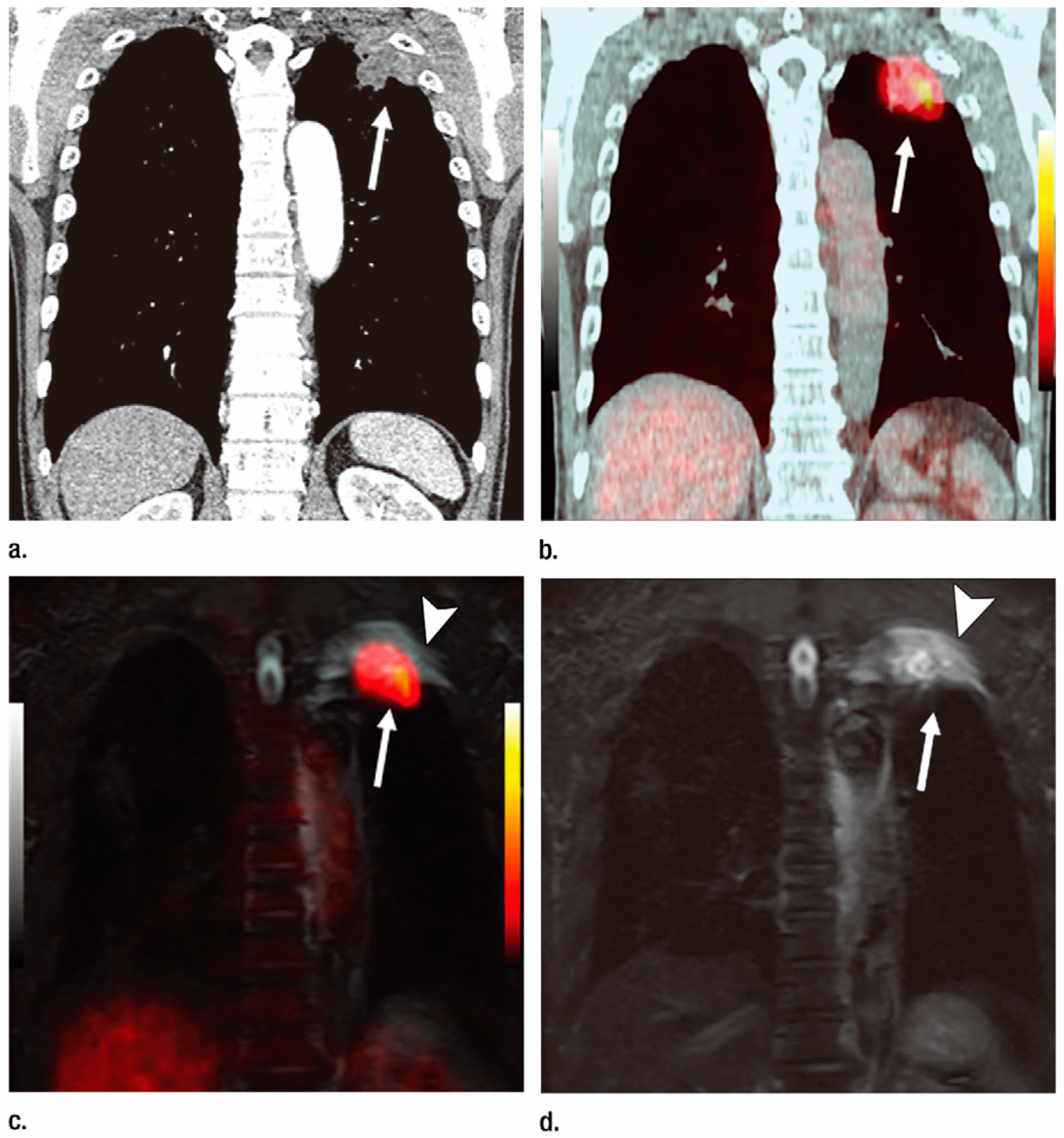 Cancers 15 00950 g003