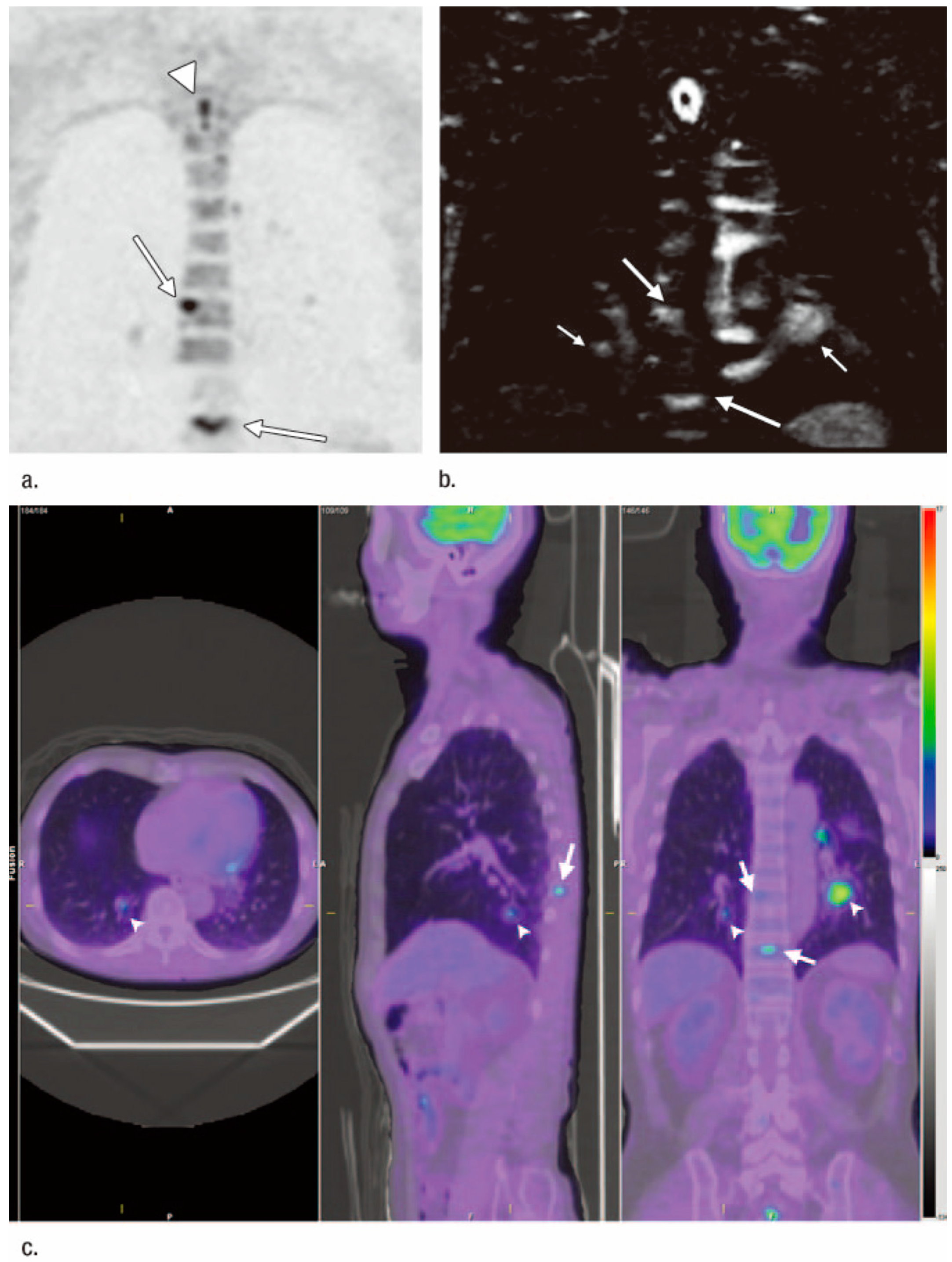 Cancers 15 00950 g005