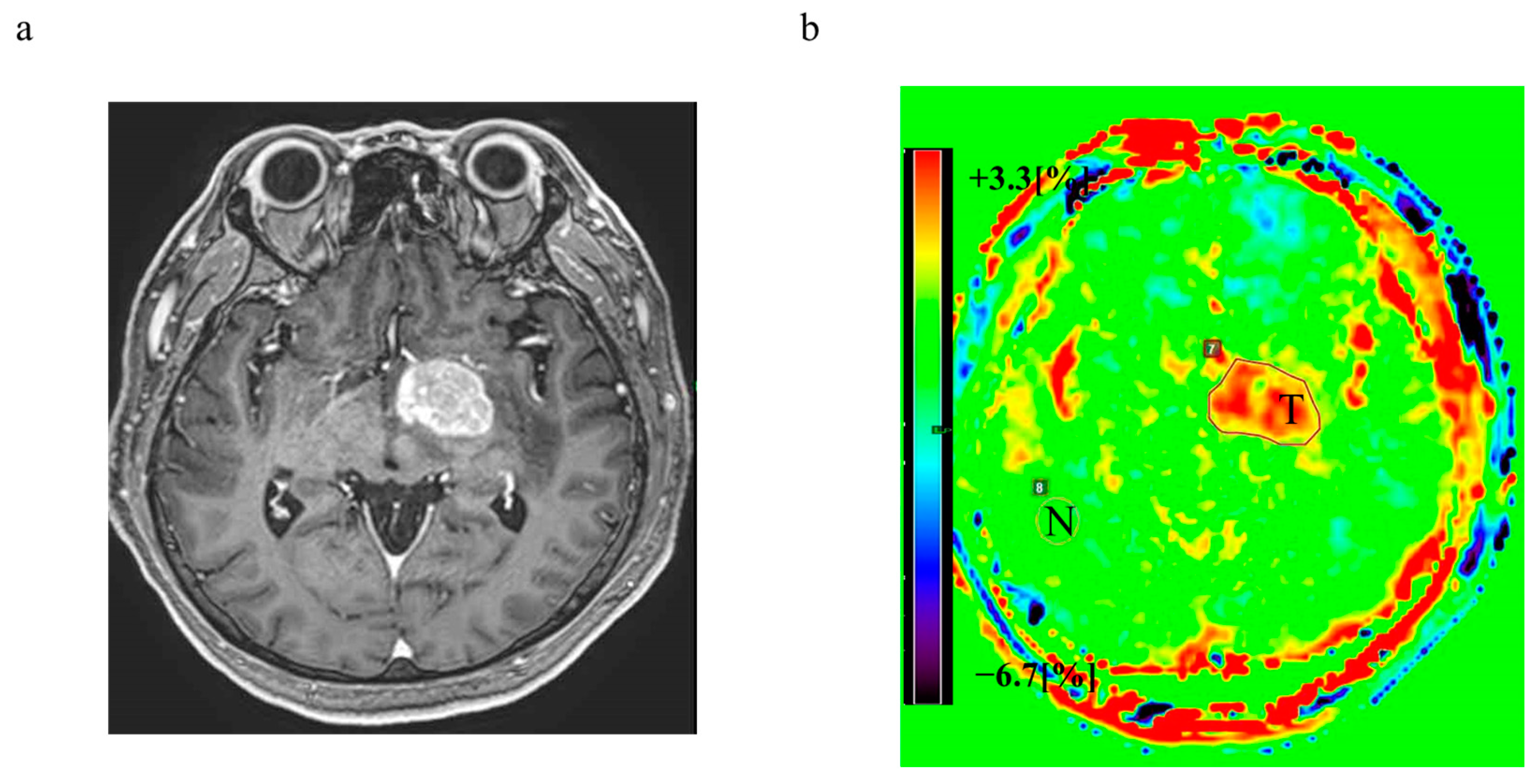 Cancers 15 00952 g001 Cancers 15 00952 g001