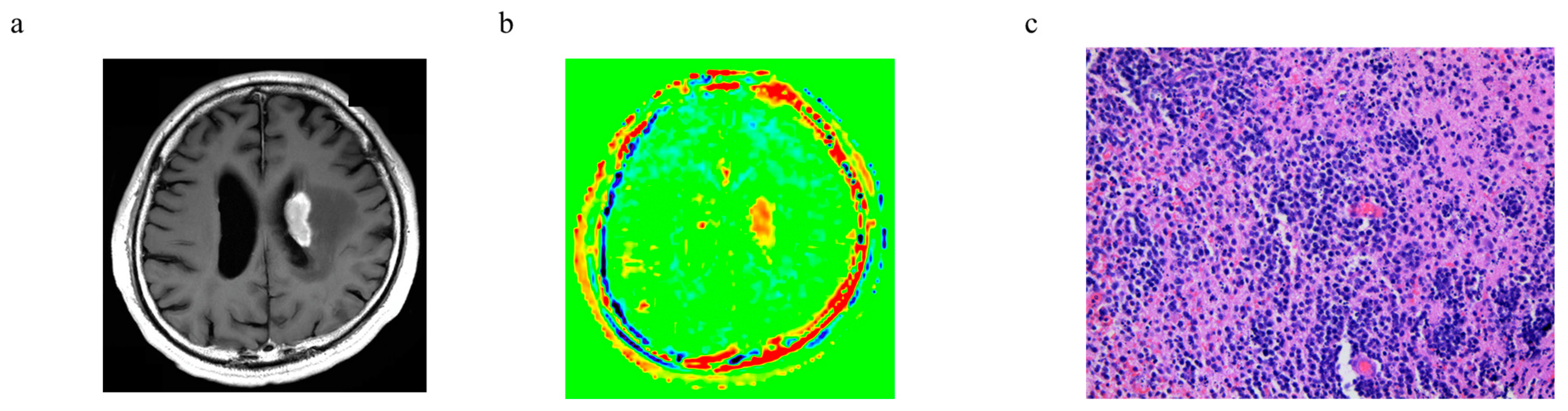 Cancers 15 00952 g005 Cancers 15 00952 g005