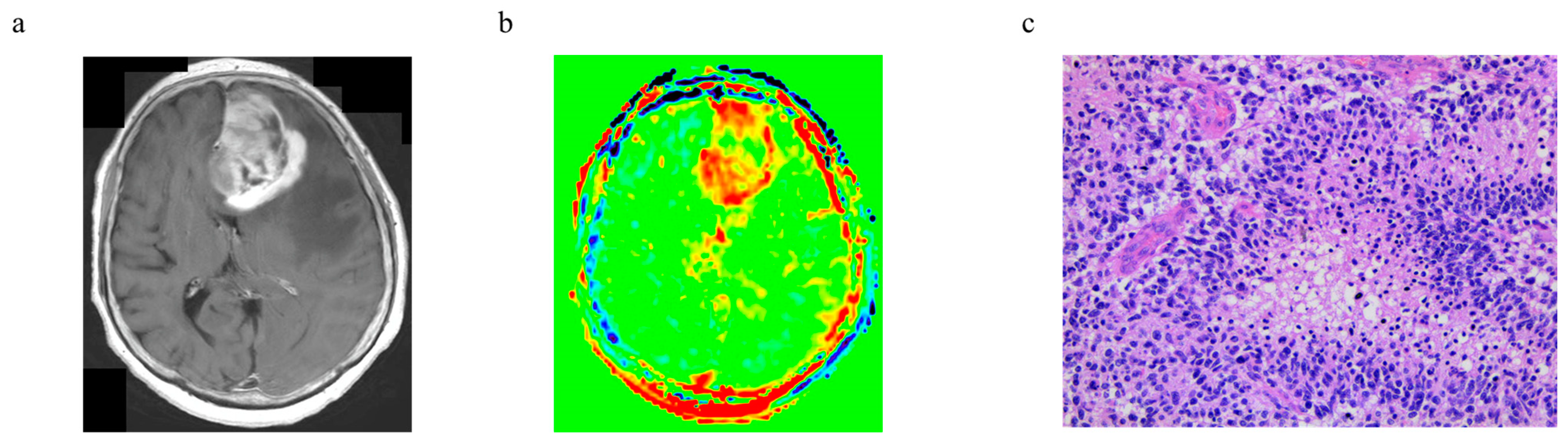 Cancers 15 00952 g006 Cancers 15 00952 g006