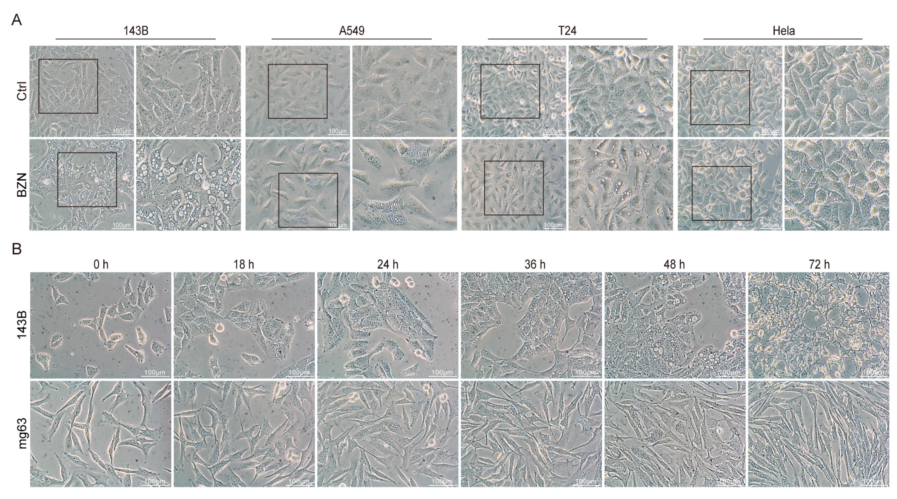 Cancers 15 00961 g006 Cancers 15 00961 g006