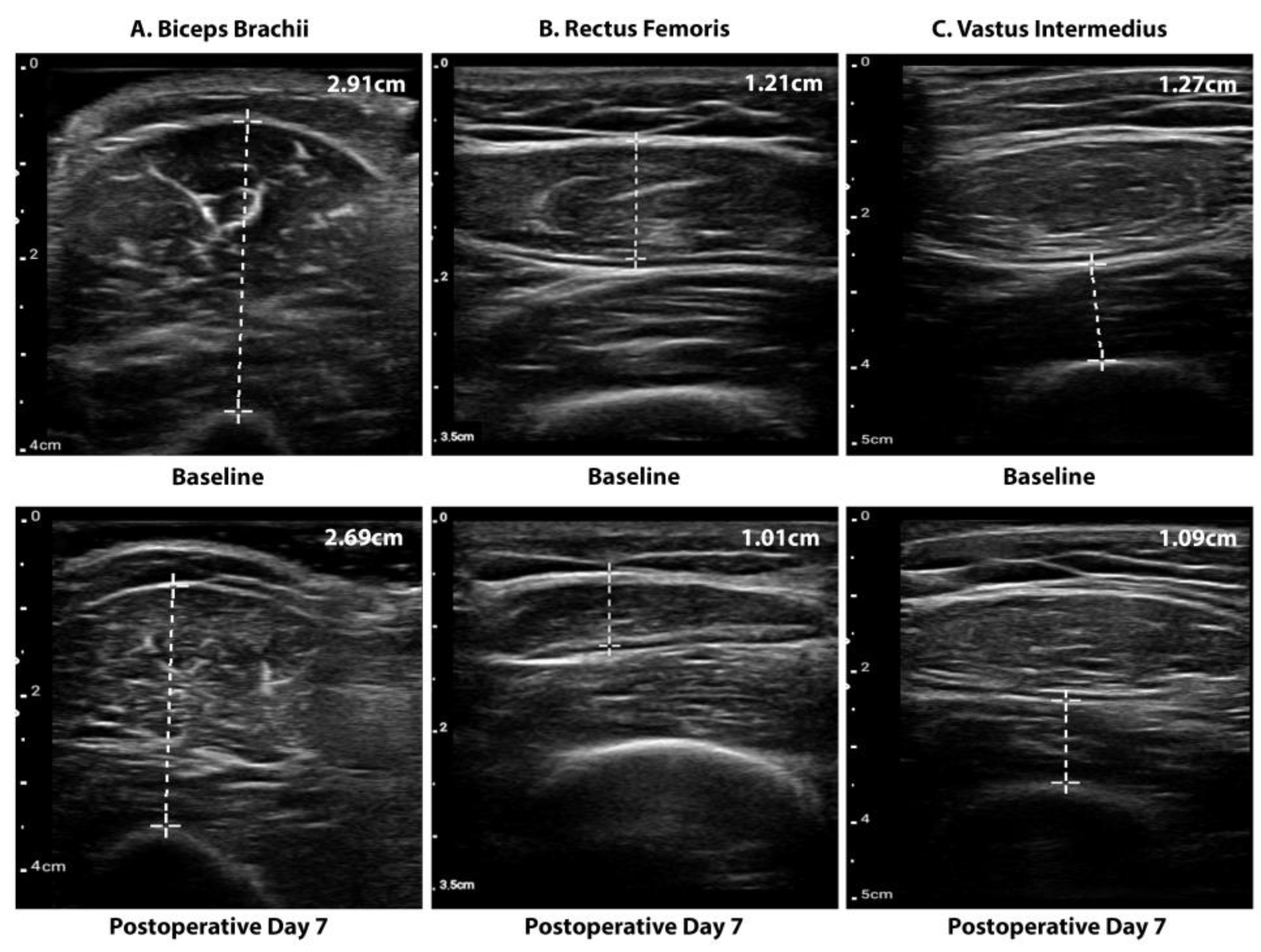 Cancers 15 00969 g001 Cancers 15 00969 g001