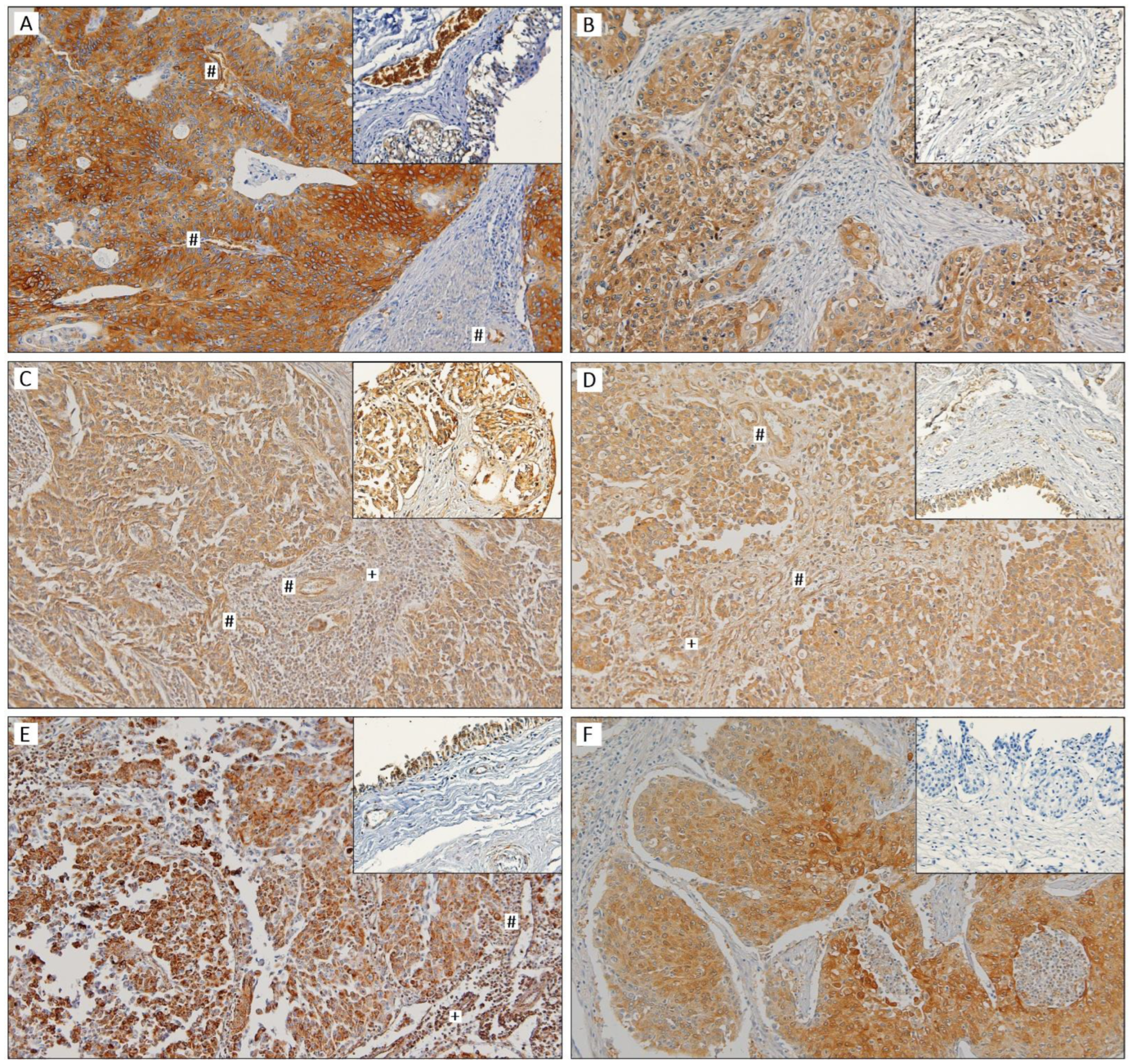 Cancers 15 00982 g001 Cancers 15 00982 g001