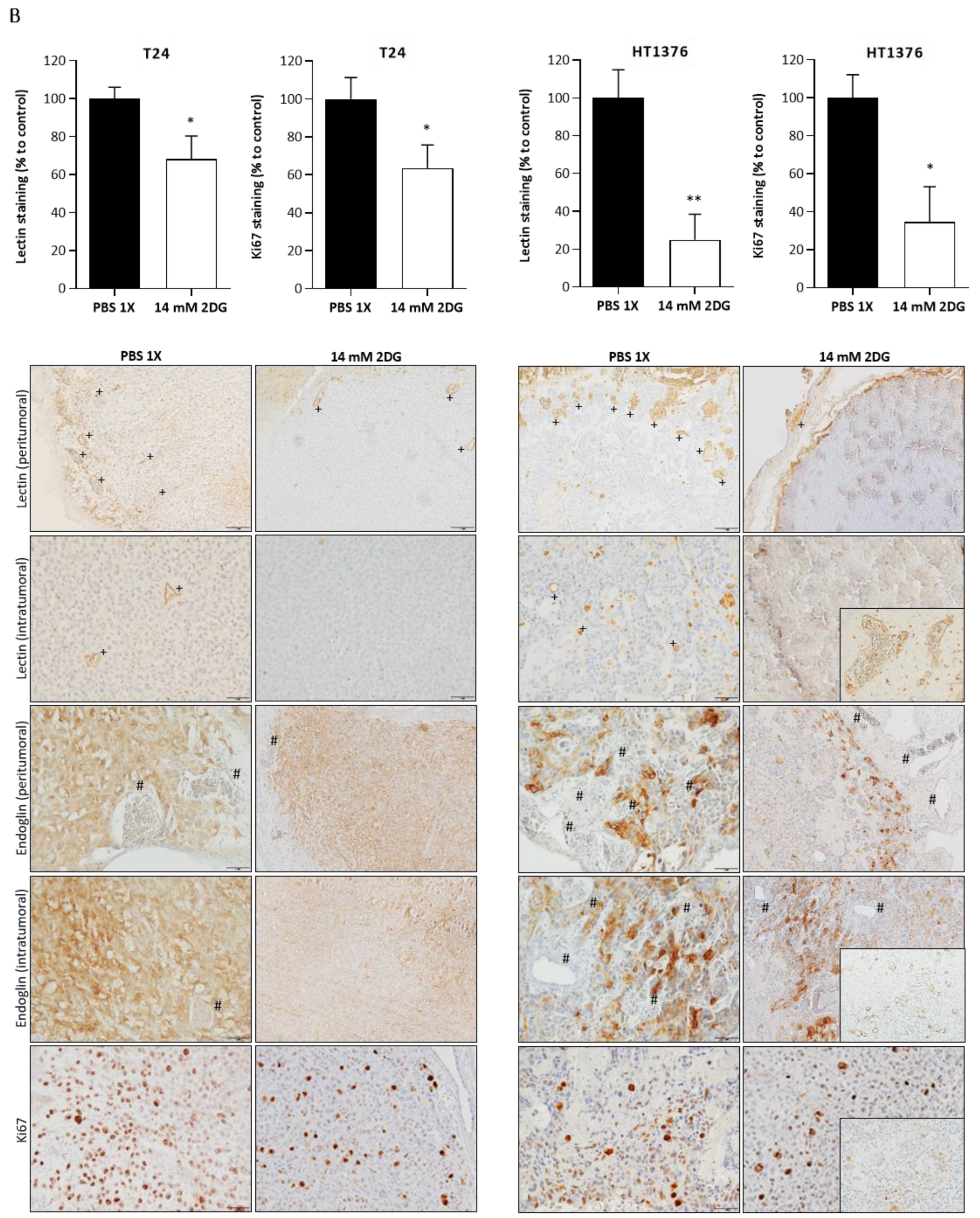 Cancers 15 00982 g009b Cancers 15 00982 g009b