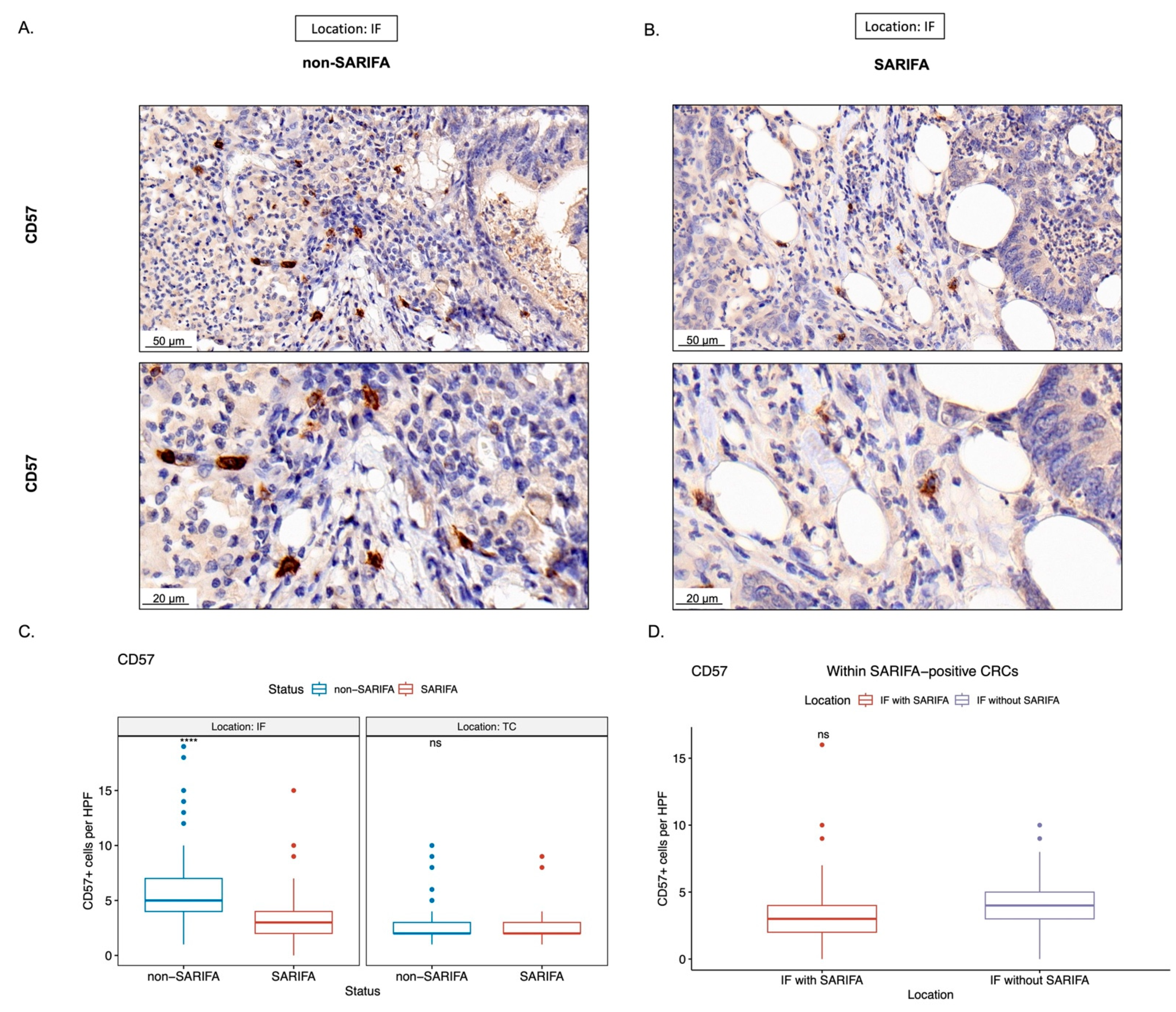 Cancers 15 00994 g005 Cancers 15 00994 g005