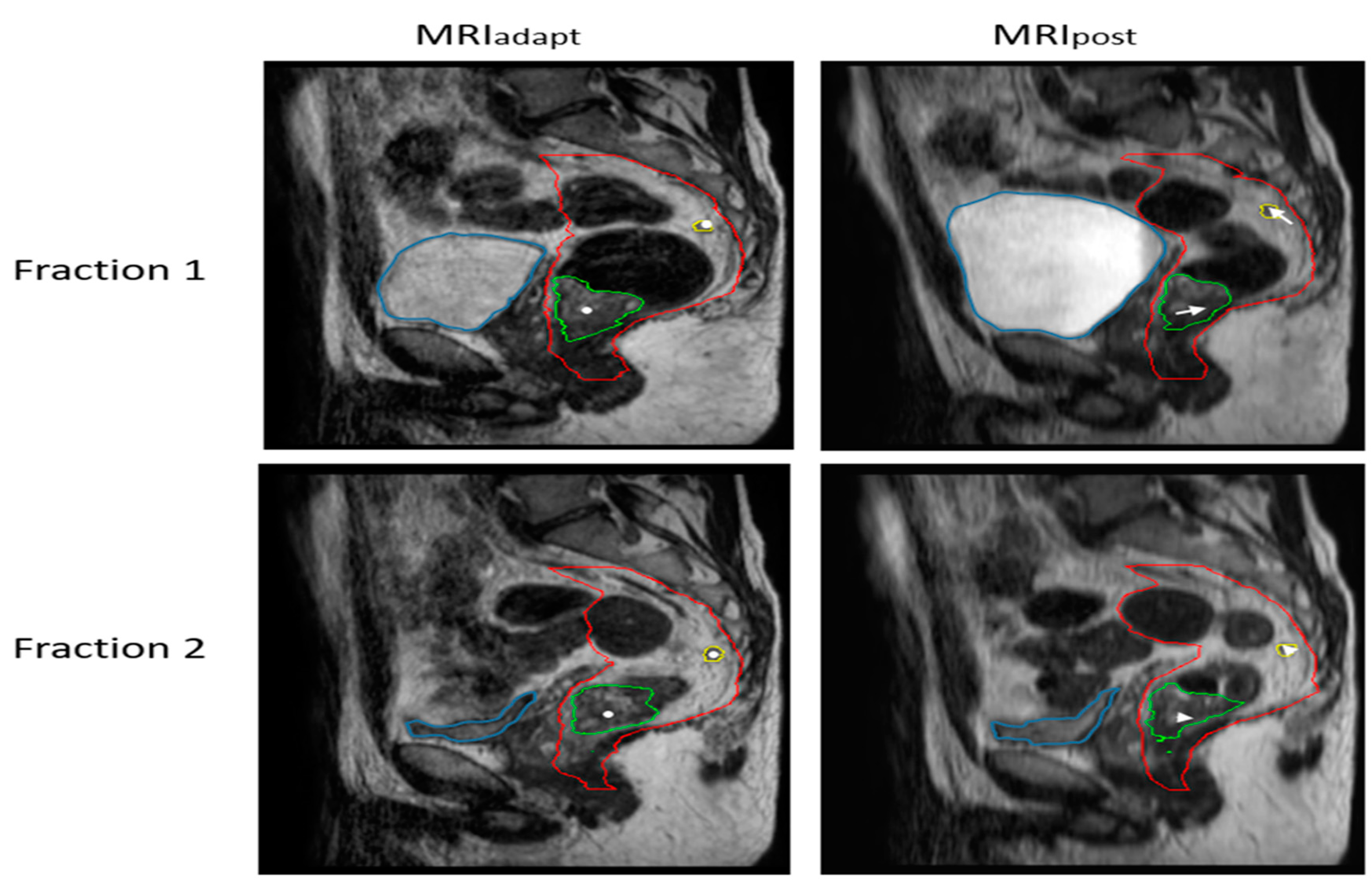 Cancers 15 01009 g001