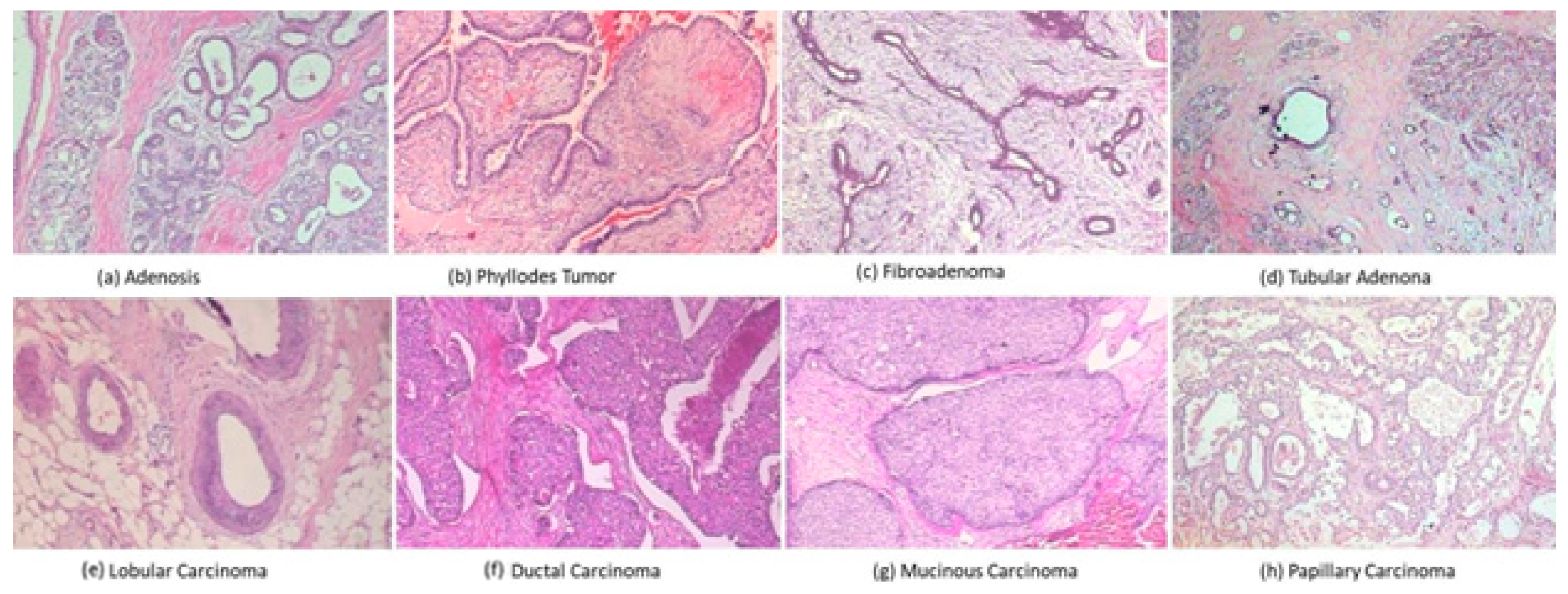 Cancers Free Full-Text FabNet A Features Agglomeration-Based Convolutional Neural Network for Multiscale Breast Cancer Histopathology Images Classification