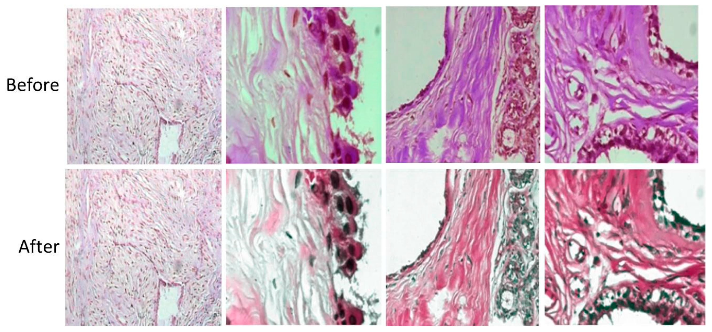 Cancers 15 01013 g005 Cancers 15 01013 g005