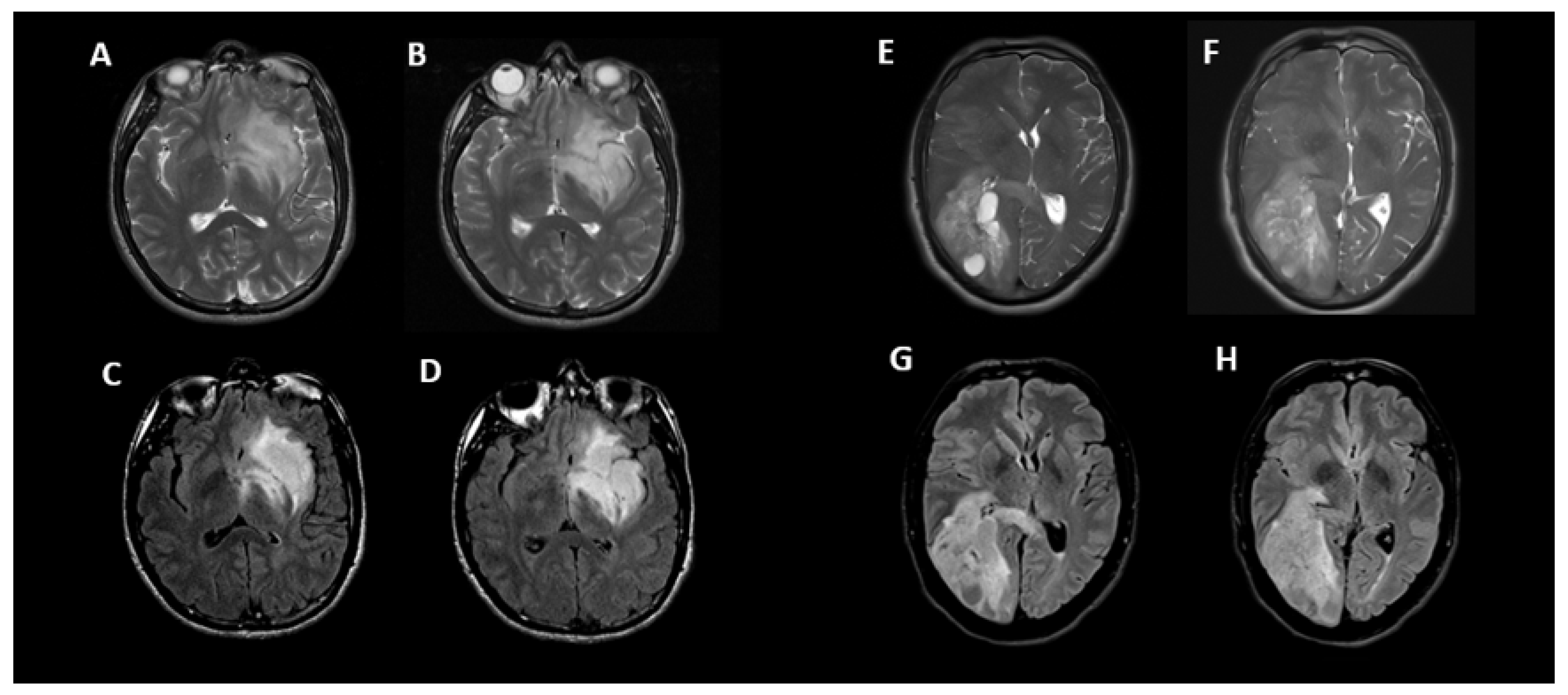 Cancers 15 01037 g004 Cancers 15 01037 g004