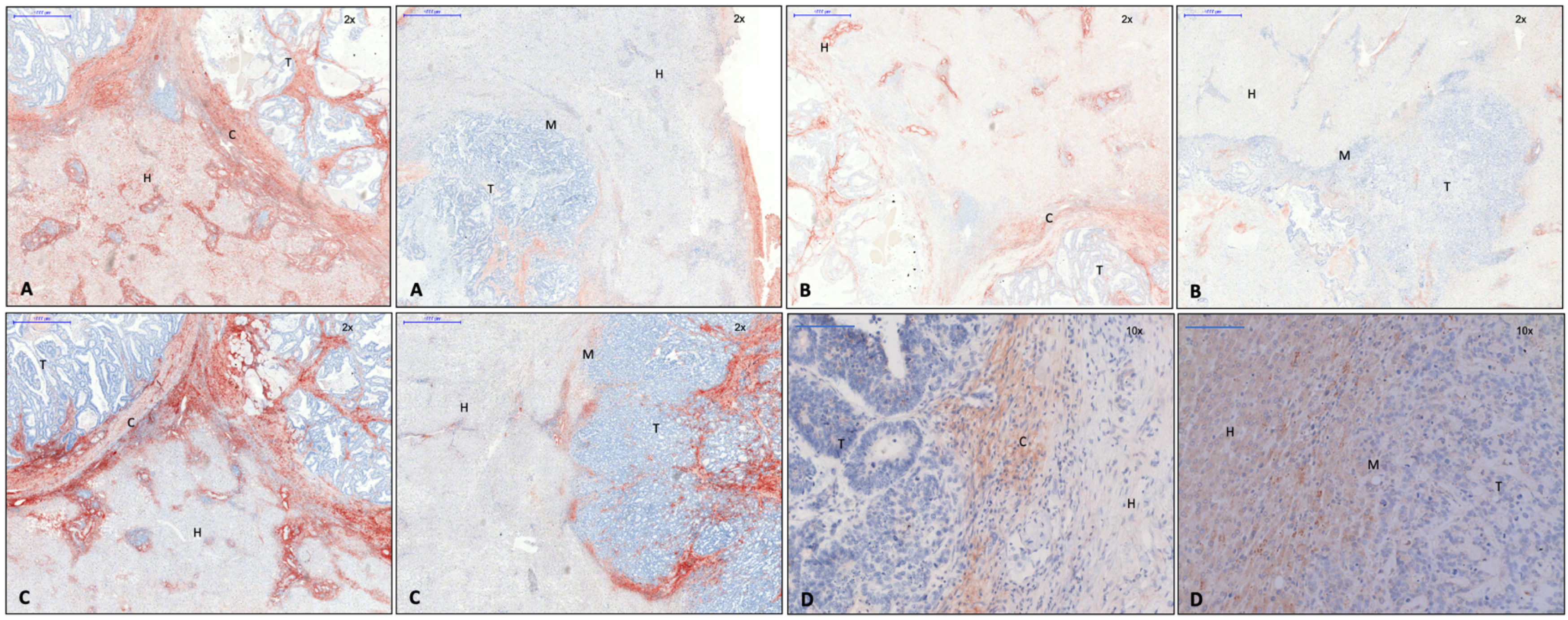 Cancers 15 01056 g001 Cancers 15 01056 g001