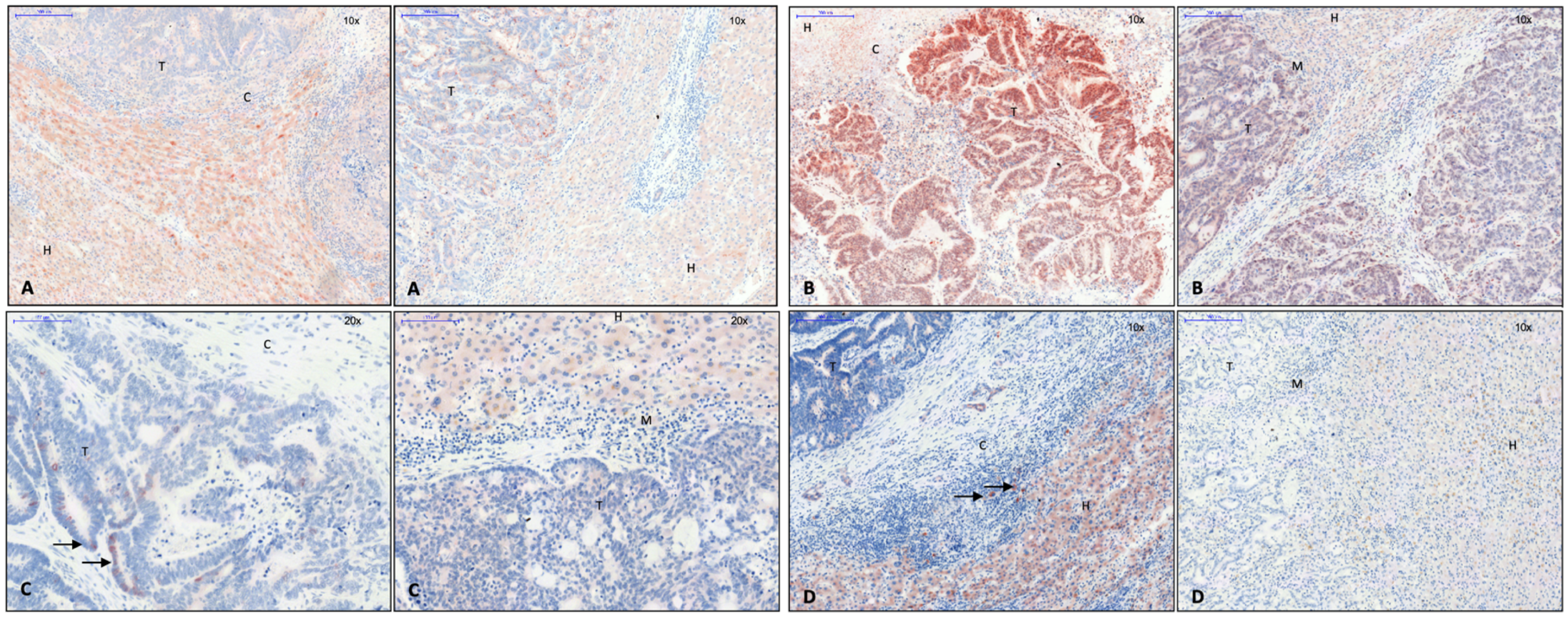 Cancers 15 01056 g003 Cancers 15 01056 g003