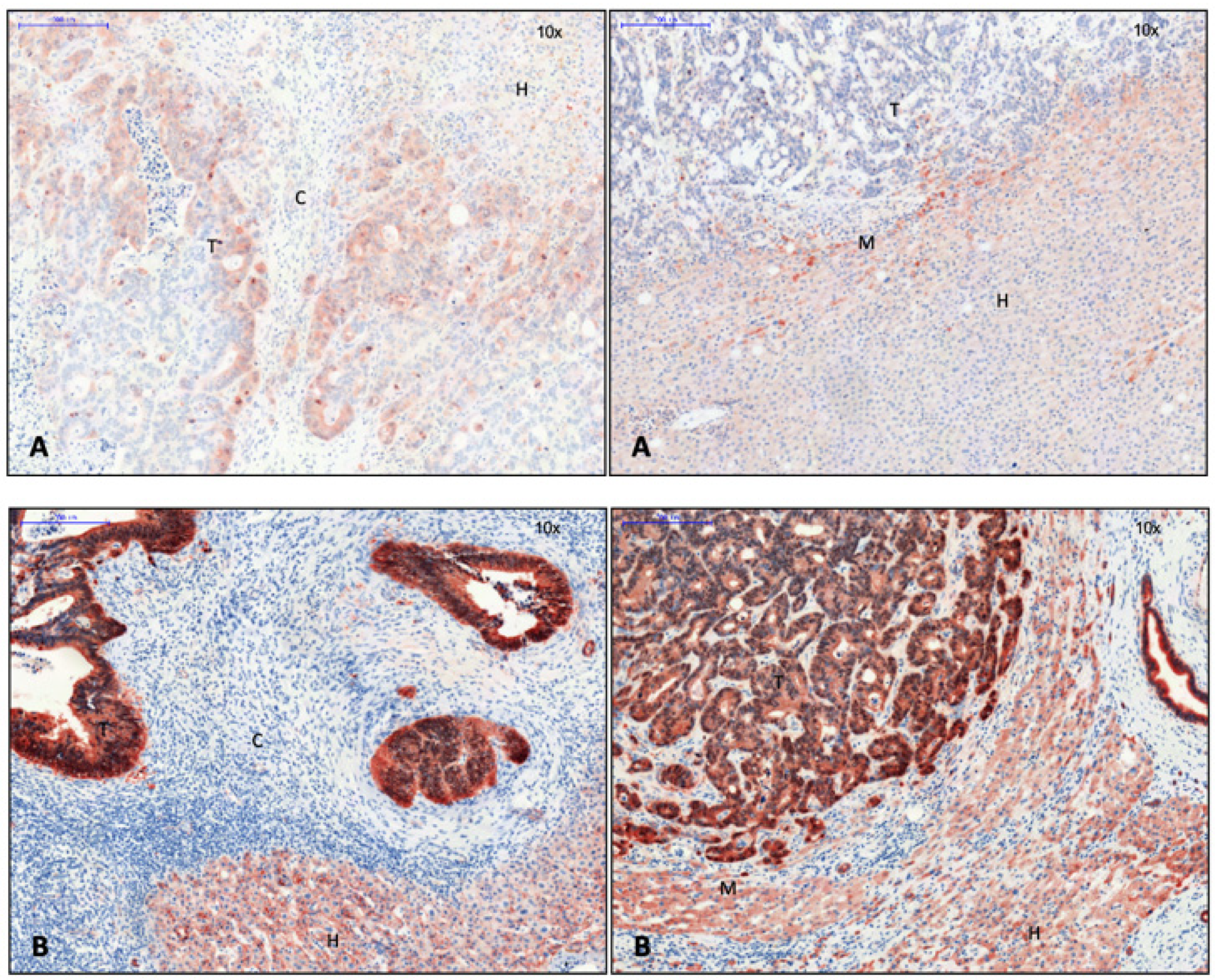 Cancers 15 01056 g004 Cancers 15 01056 g004