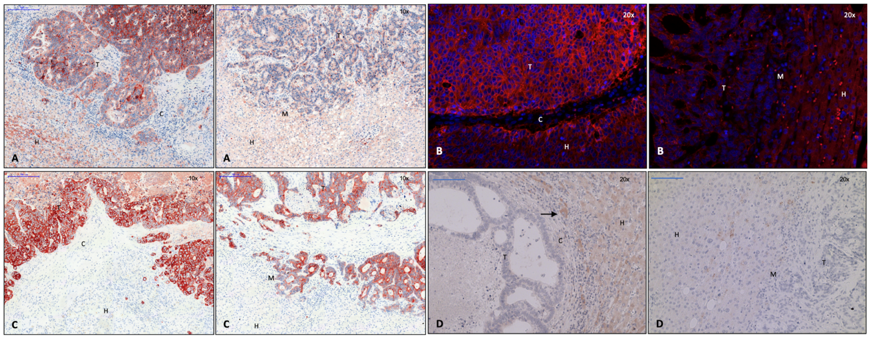 Cancers 15 01056 g005 Cancers 15 01056 g005