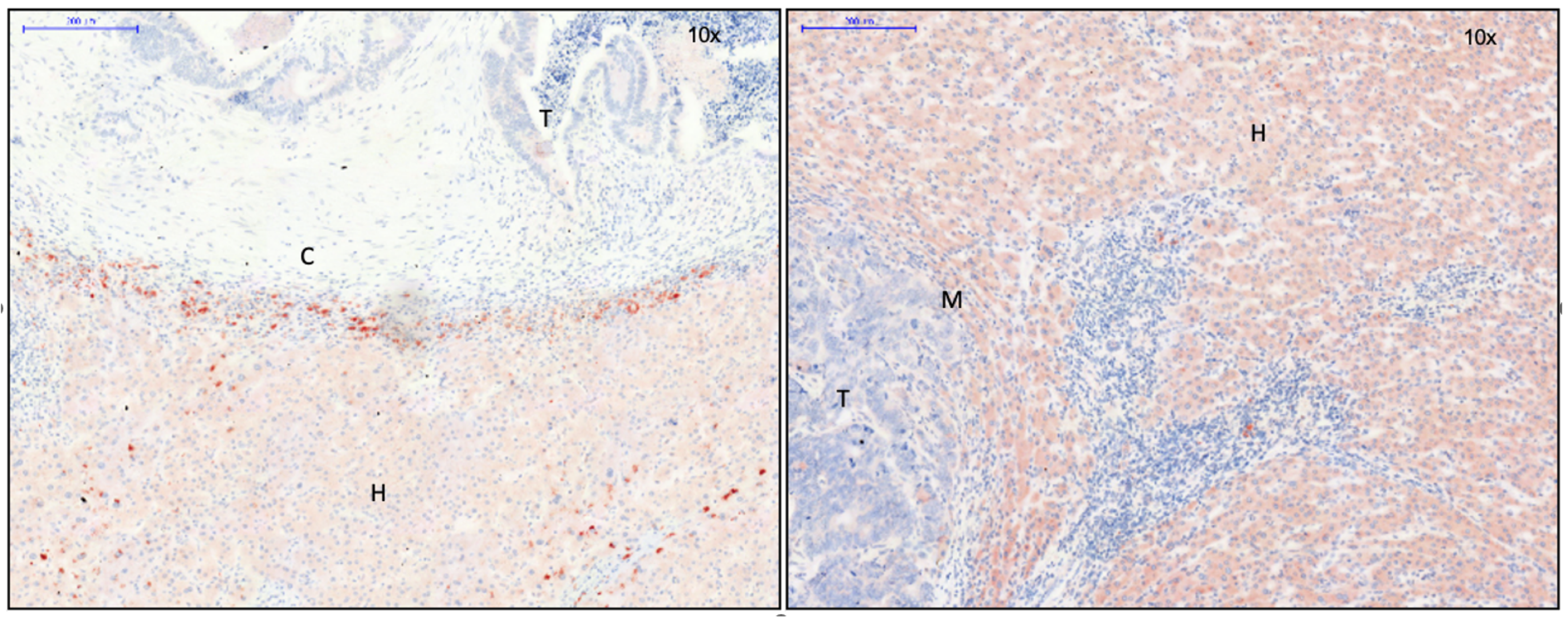 Cancers 15 01056 g006 Cancers 15 01056 g006